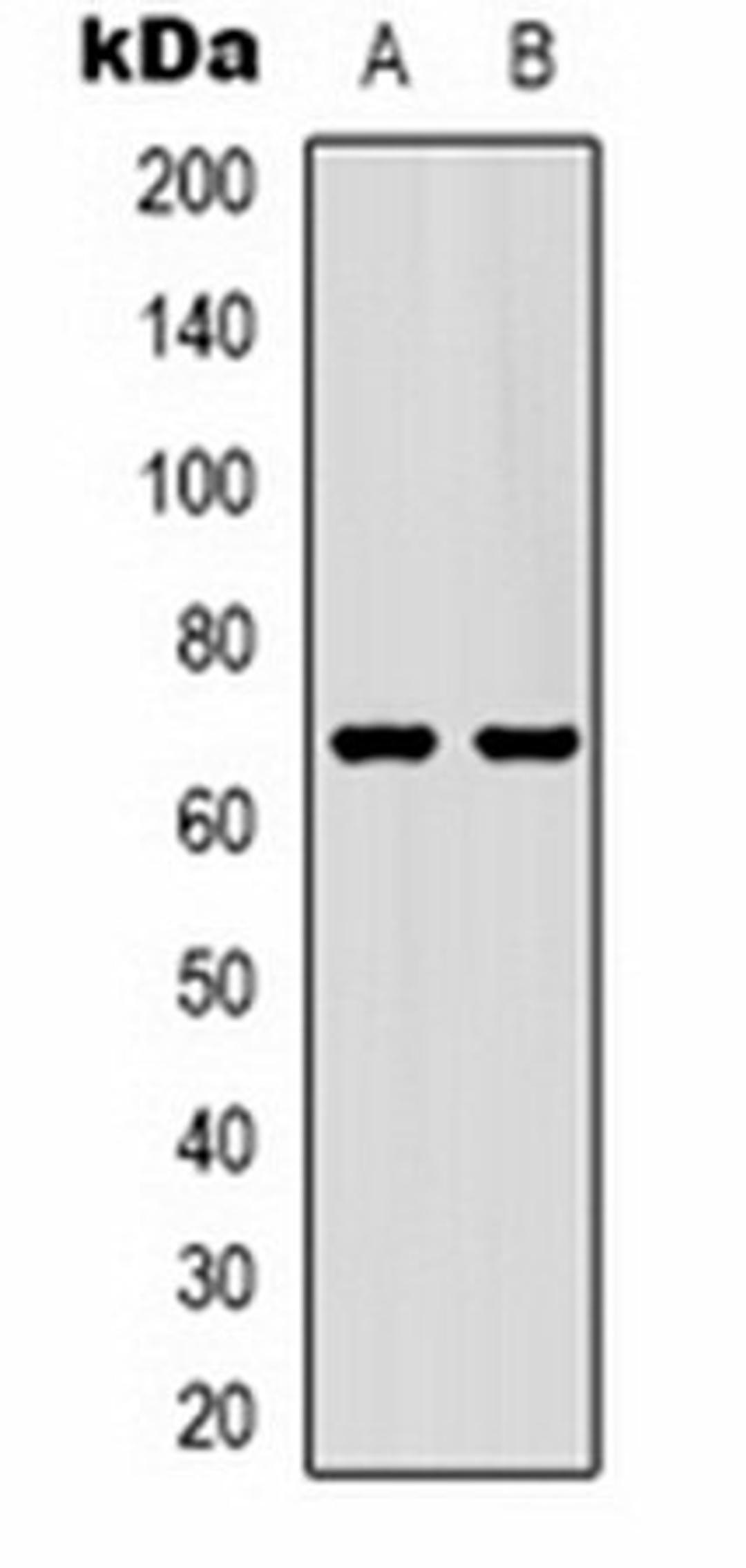 Western blot analysis of mouse brain (Lane 1), rat brain (Lane 2) whole cell lysates using GAT1 antibody