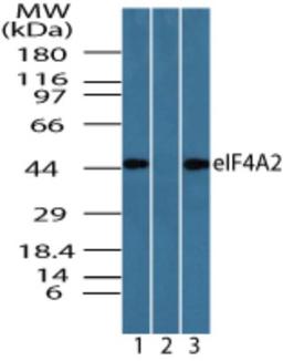 Western Blot: eIF4A2 Antibody [NBP2-24529] - analysis of eIF4A2 in Jurkat cell lysate in the 1) absence, 2) presence of immunizing peptide and 3) 3T3 cell lysate using eIF4A2 antibody at 0.05 ug/ml, 0.05 ug/ml and 0.025 ug/ml, respectively.