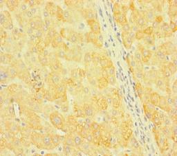 Immunohistochemistry of paraffin-embedded human liver tissue using CSB-PA806844LA01HU at dilution of 1:100