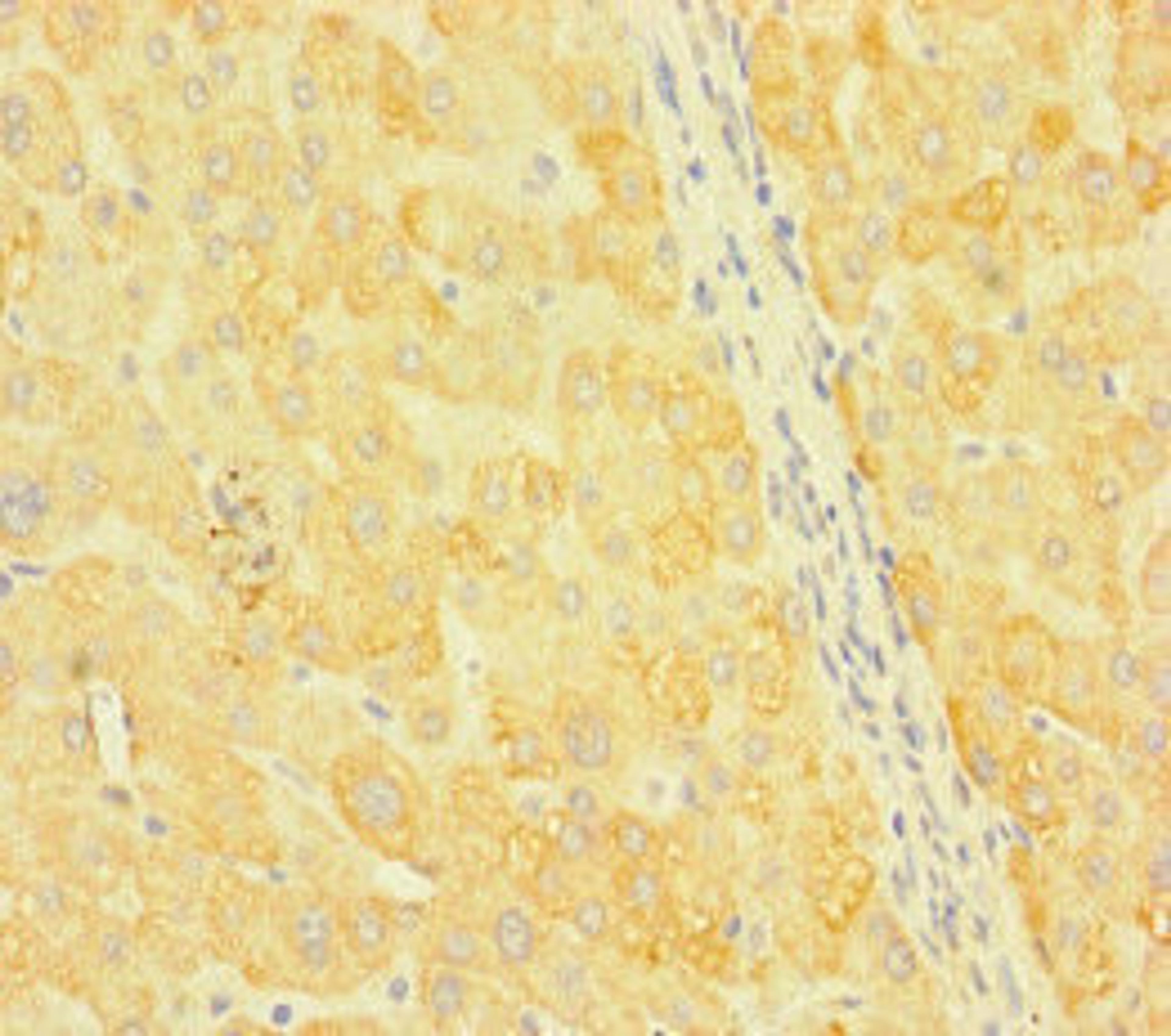 Immunohistochemistry of paraffin-embedded human liver tissue using CSB-PA806844LA01HU at dilution of 1:100