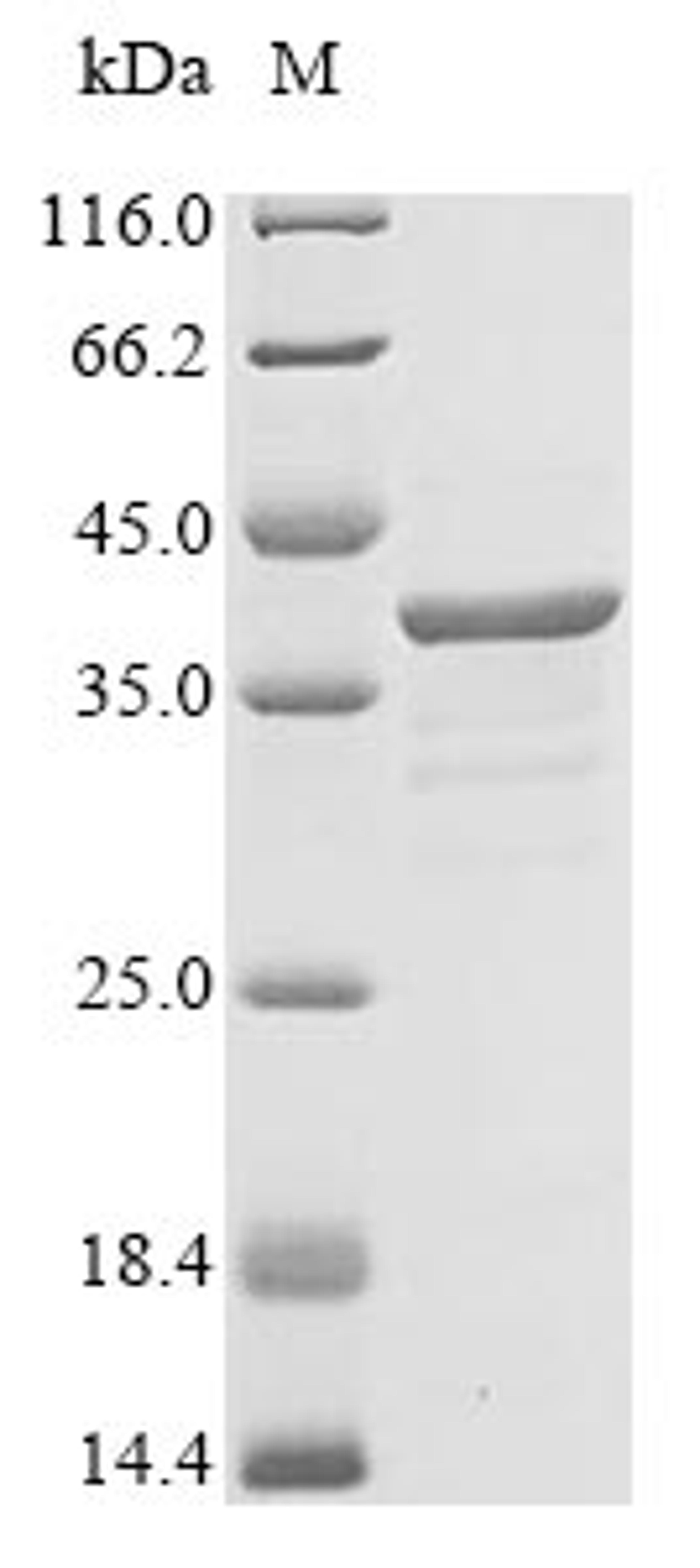 (Tris-Glycine gel) Discontinuous SDS-PAGE (reduced) with 5% enrichment gel and 15% separation gel.