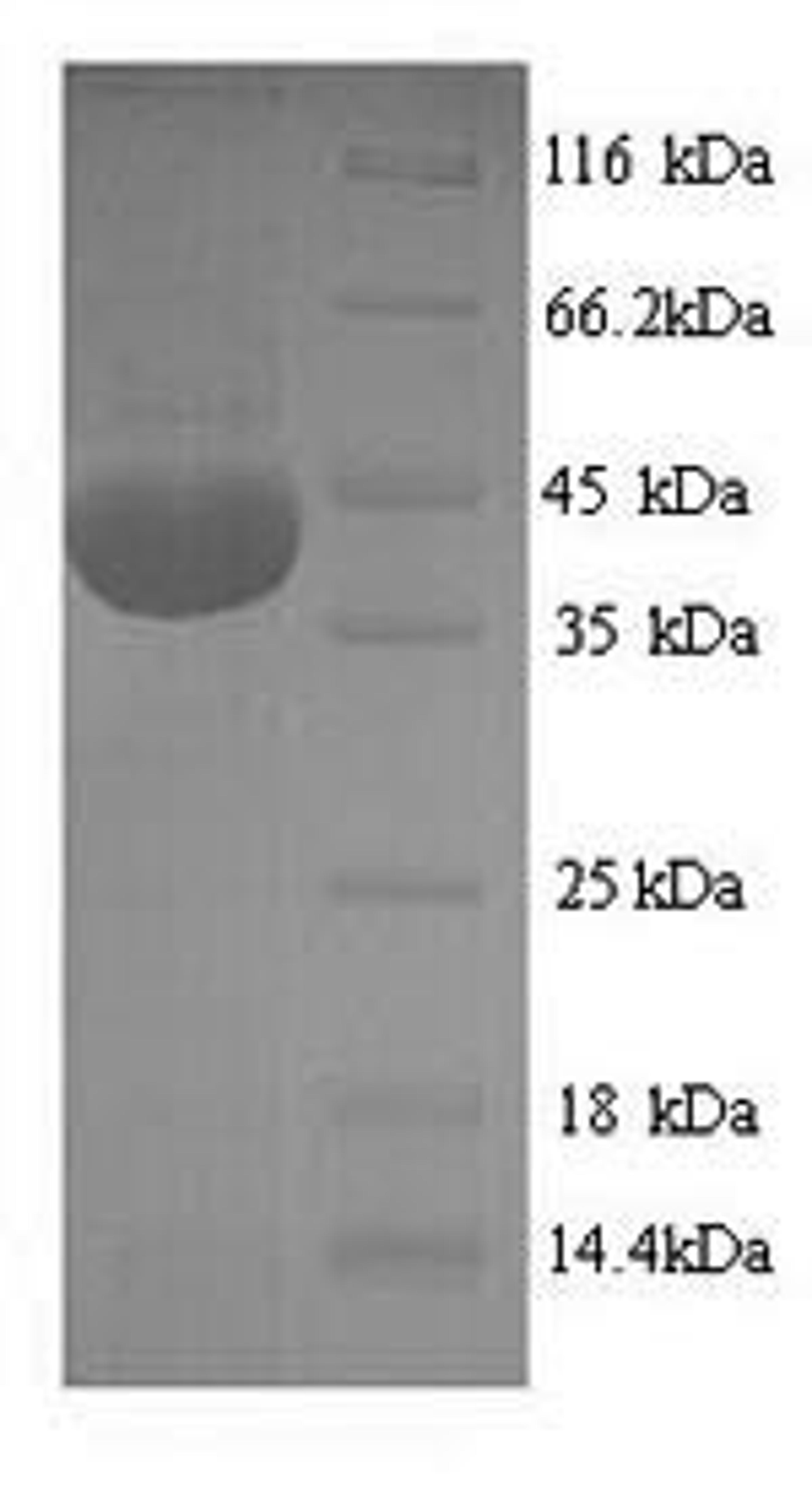 (Tris-Glycine gel) Discontinuous SDS-PAGE (reduced) with 5% enrichment gel and 15% separation gel.