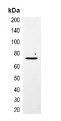 Western blot analysis of 293T cell lysate using mCherry-tag antibody