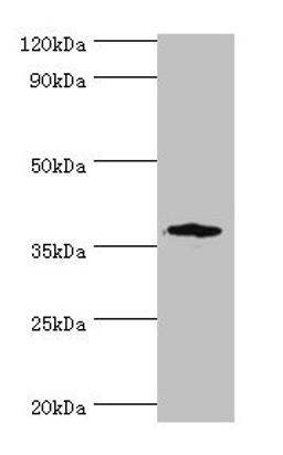 Western blot. All lanes: CD200R1 antibody at 6ug/ml + Mouse lung tissue. Secondary. Goat polyclonal to rabbit IgG at 1/10000 dilution. Predicted band size: 37, 22, 19, 40 kDa. Observed band size: 37 kDa. 