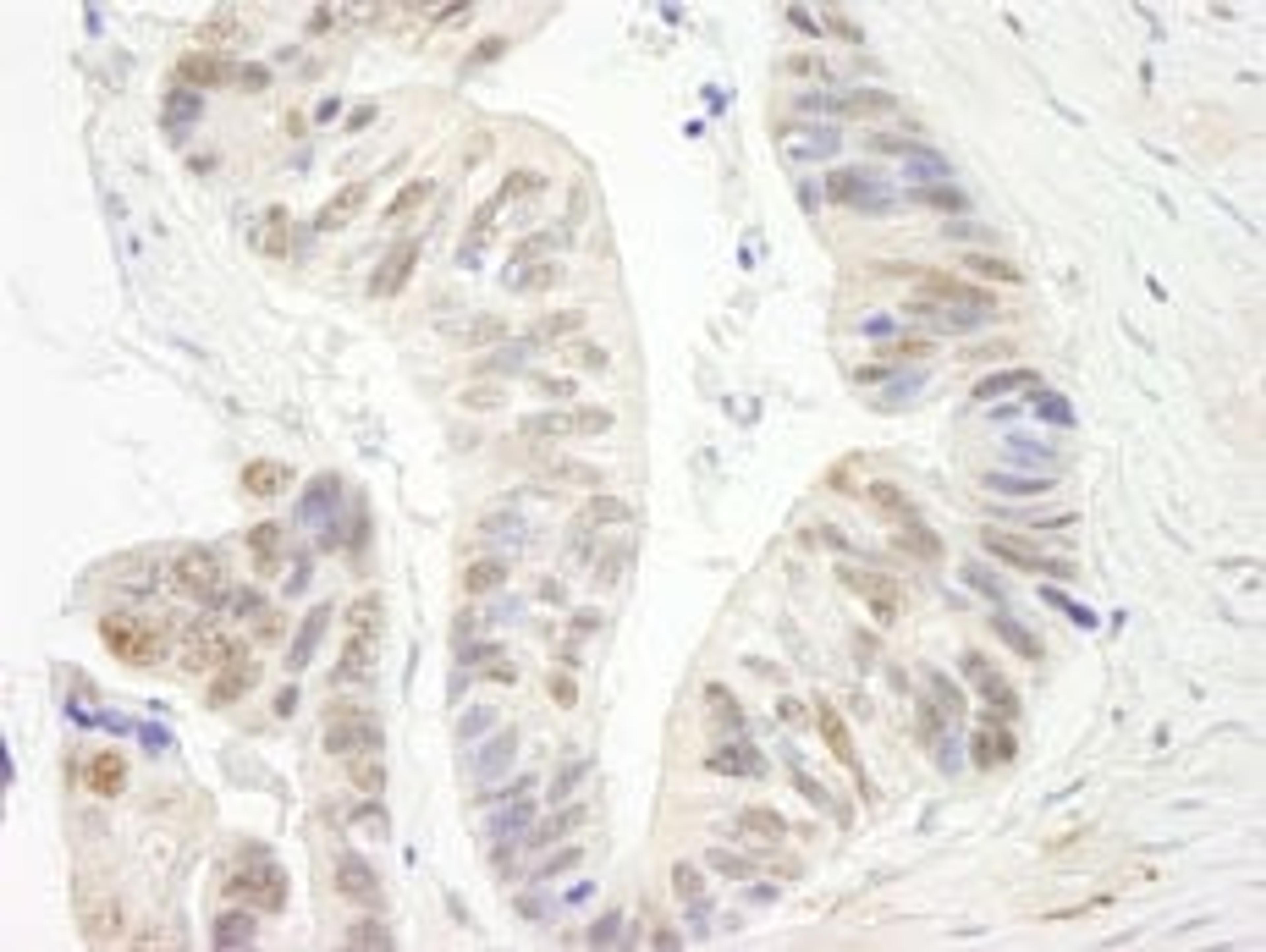 Detection of human ERCC5/XPG immunohistochemistry.