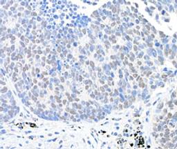 Detection of human USP28 by immunohistochemistry.