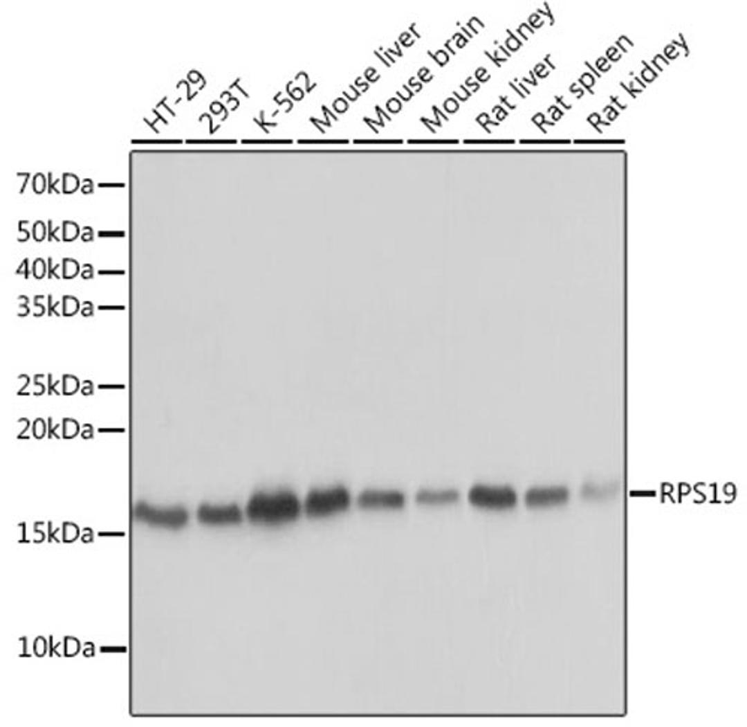 Western blot - RPS19 Rabbit mAb (A3675)