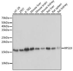 Western blot - RPS19 Rabbit mAb (A3675)