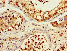 Immunohistochemistry of paraffin-embedded human testis tissue using CSB-PA019603LA01HU at dilution of 1:100