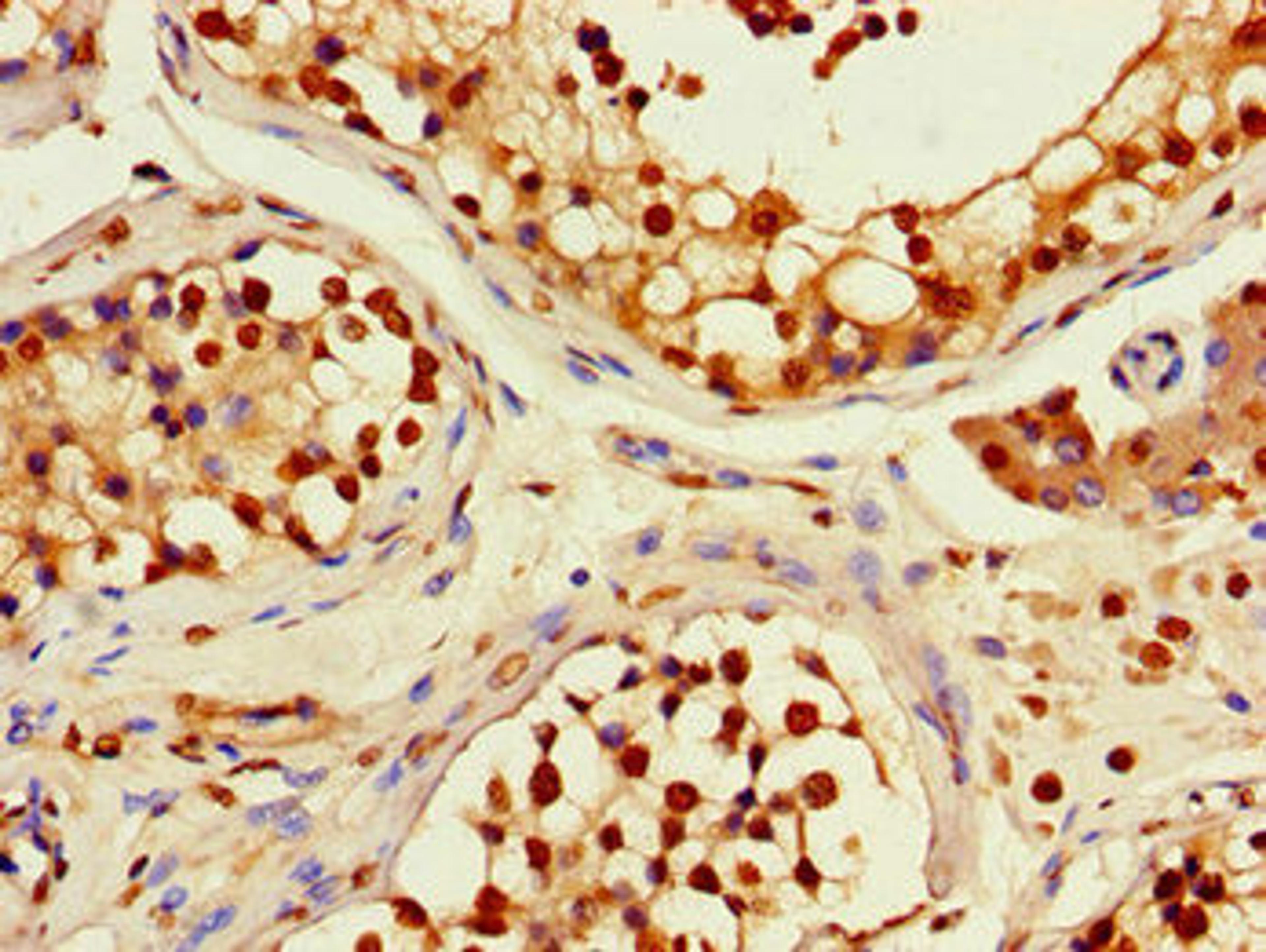 Immunohistochemistry of paraffin-embedded human testis tissue using CSB-PA019603LA01HU at dilution of 1:100