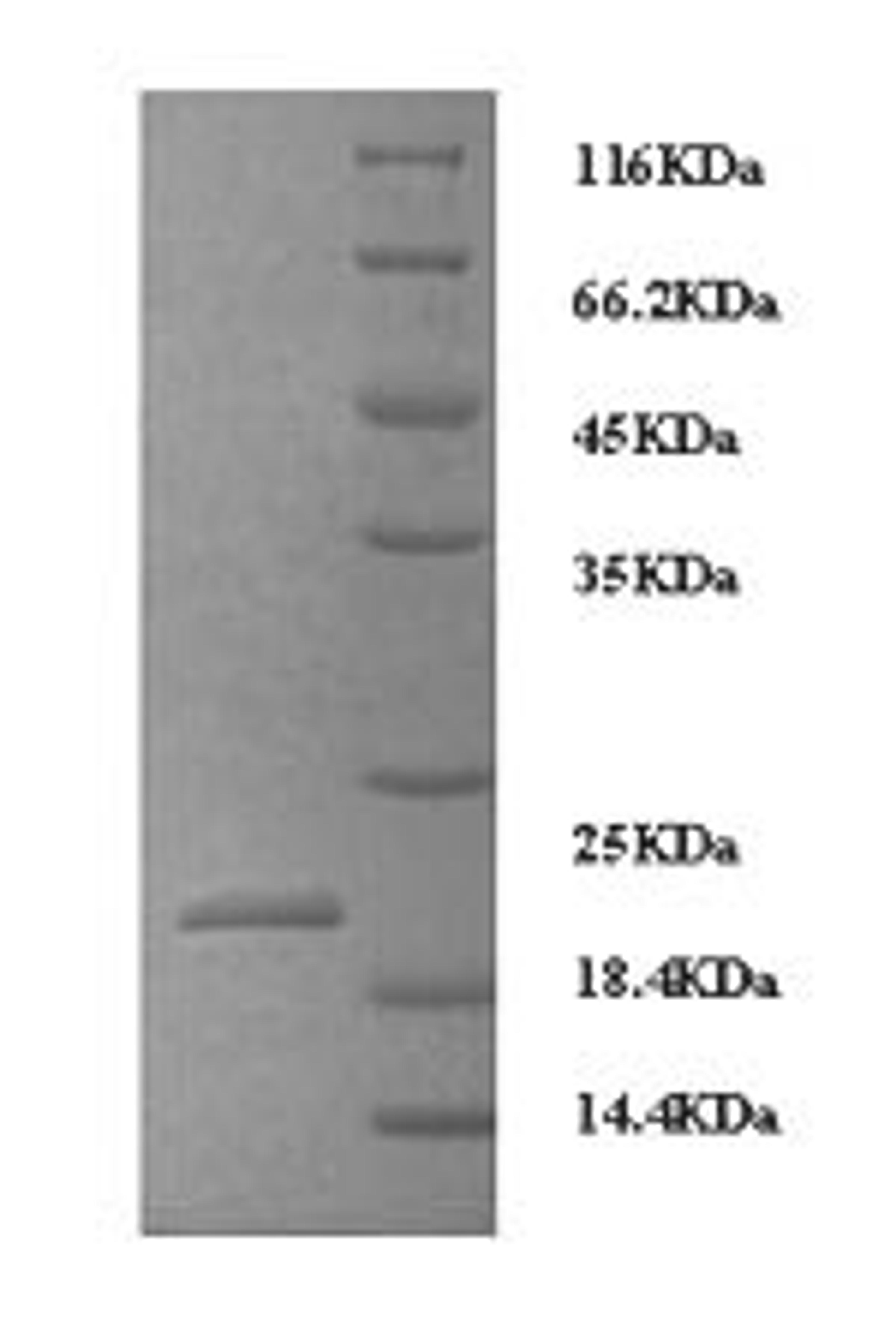 (Tris-Glycine gel) Discontinuous SDS-PAGE (reduced) with 5% enrichment gel and 15% separation gel.