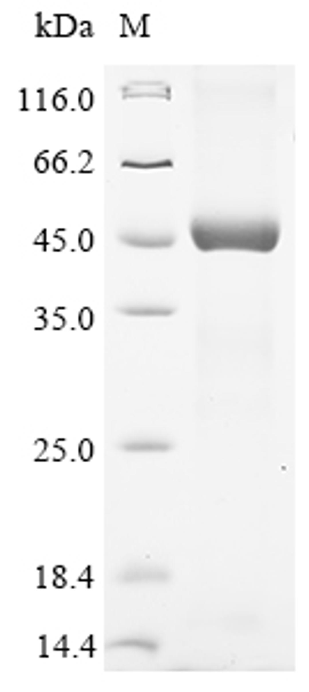 (Tris-Glycine gel) Discontinuous SDS-PAGE (reduced) with 5% enrichment gel and 15% separation gel.