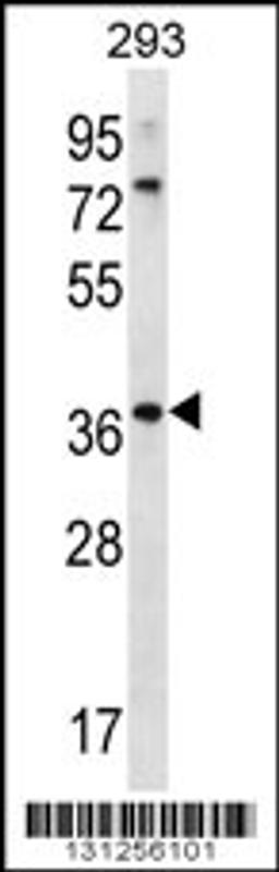 Western blot analysis in 293 cell line lysates (35ug/lane).