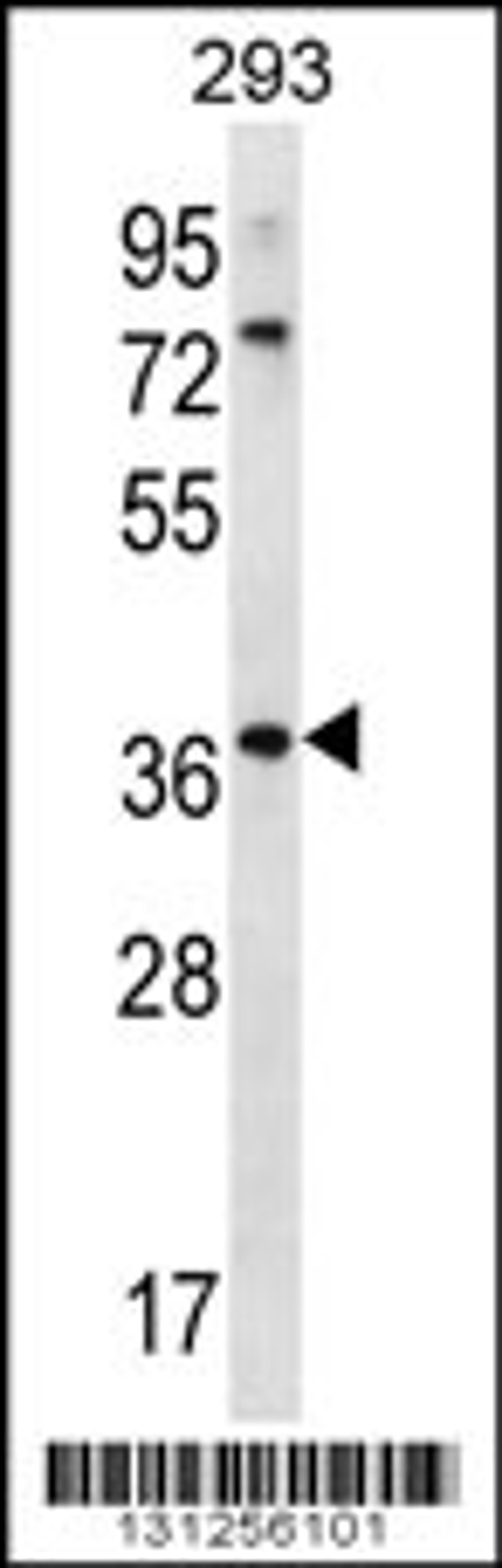 Western blot analysis in 293 cell line lysates (35ug/lane).