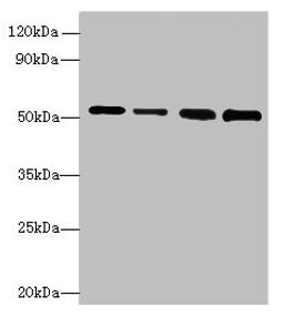 Western blot. All lanes: STK38L antibody at 6ug/ml. Lane 1: A375 whole cell lysate. Lane 2: HepG2 whole cell lysate. Lane 3: A549 whole cell lysate. Lane 4: HCT116 whole cell lysate. Secondary. Goat polyclonal to rabbit IgG at 1/10000 dilution. Predicted band size: 55, 44 kDa. Observed band size: 55 kDa.