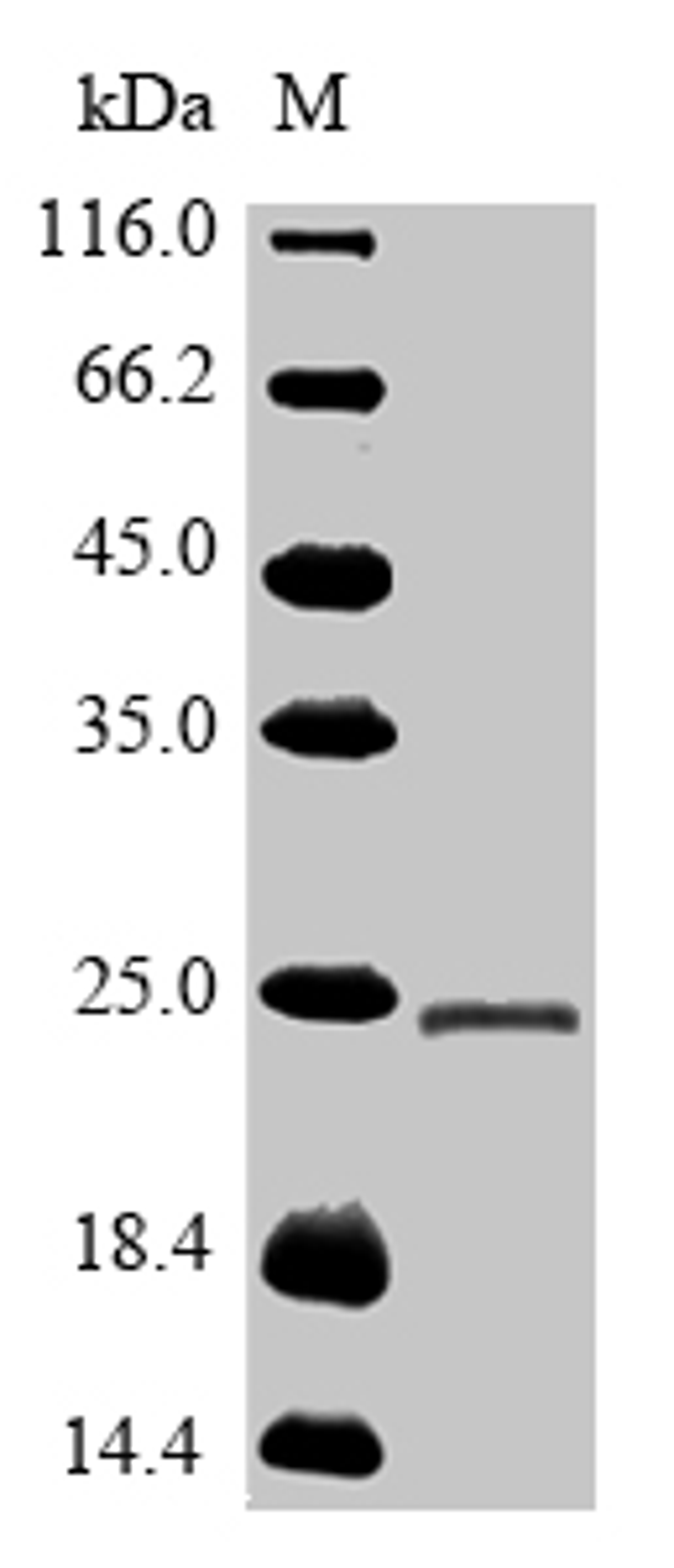 (Tris-Glycine gel) Discontinuous SDS-PAGE (reduced) with 5% enrichment gel and 15% separation gel.