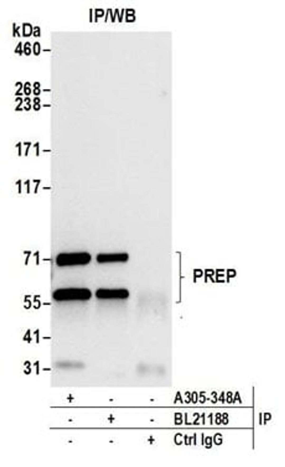 Detection of human PREP by western blot of immunoprecipitates.