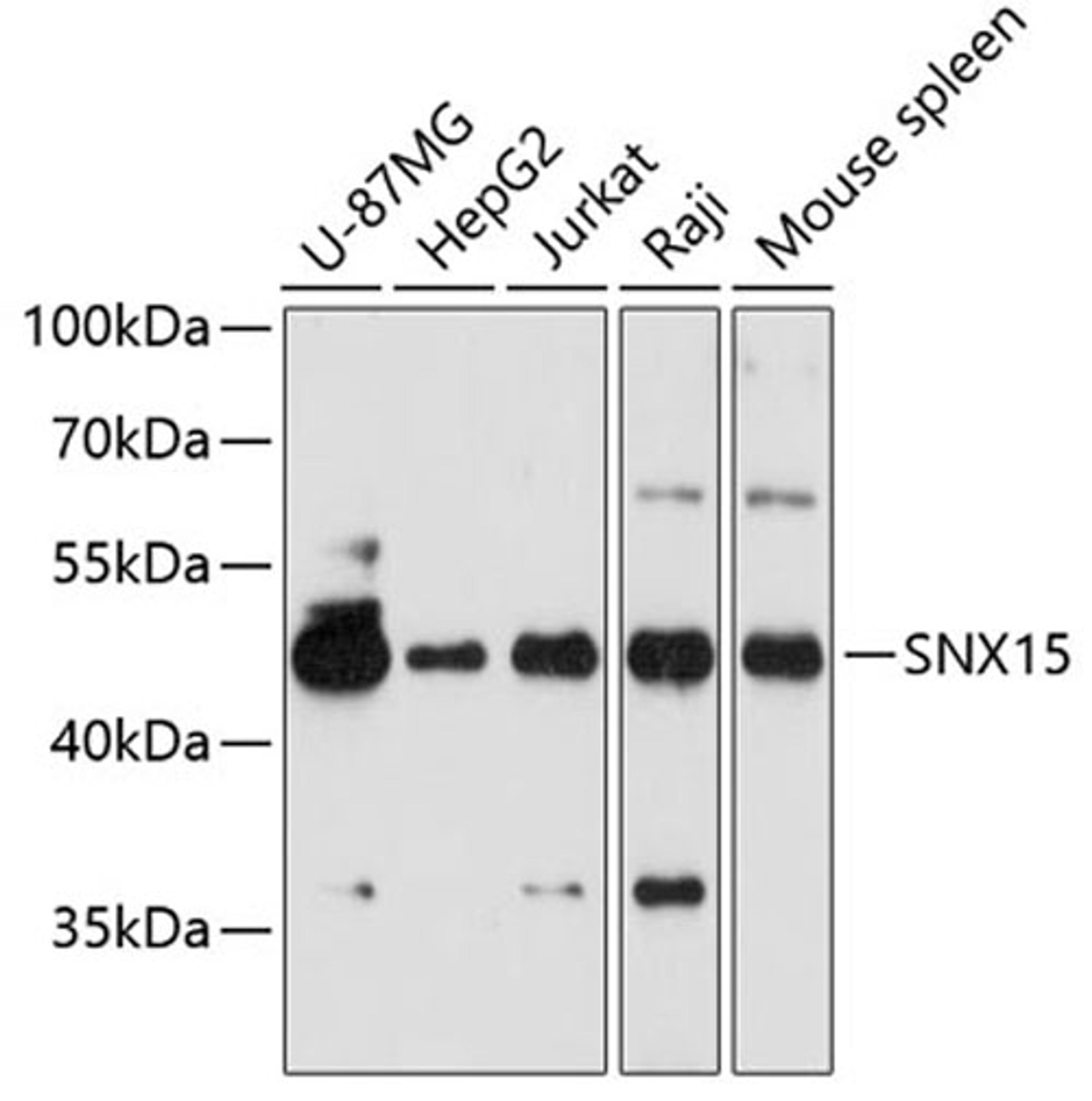 Western blot - SNX15 antibody (A9158)