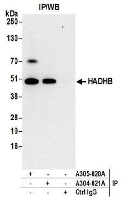 Detection of human HADHB by western blot of immunoprecipitates.