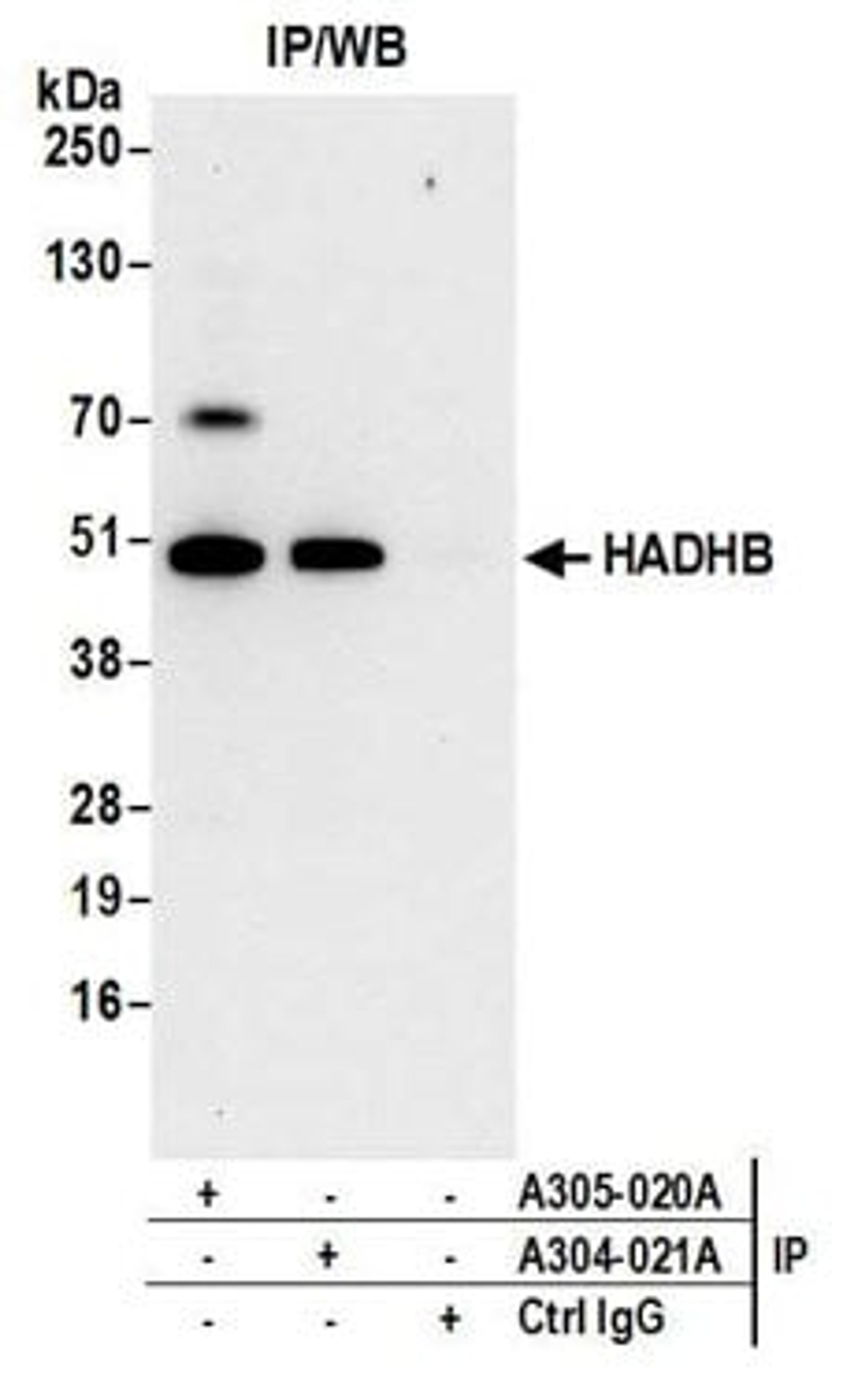 Detection of human HADHB by western blot of immunoprecipitates.