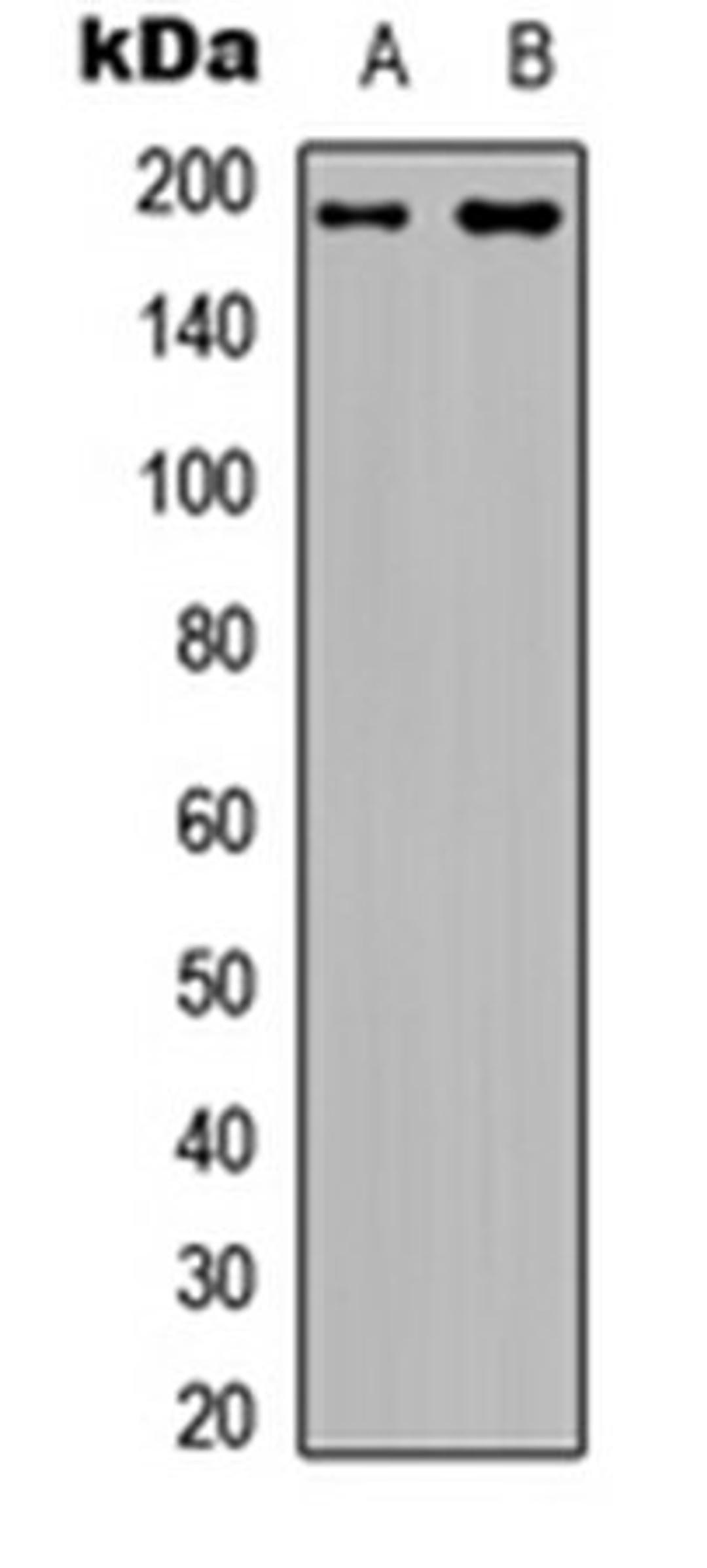 Western blot analysis of HEK293T (Lane 1), rat muscle (Lane 2) whole cell lysates using IRS1 (Phospho-S794) antibody