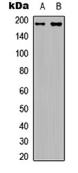 Western blot analysis of HEK293T (Lane 1), rat muscle (Lane 2) whole cell lysates using IRS1 (Phospho-S794) antibody