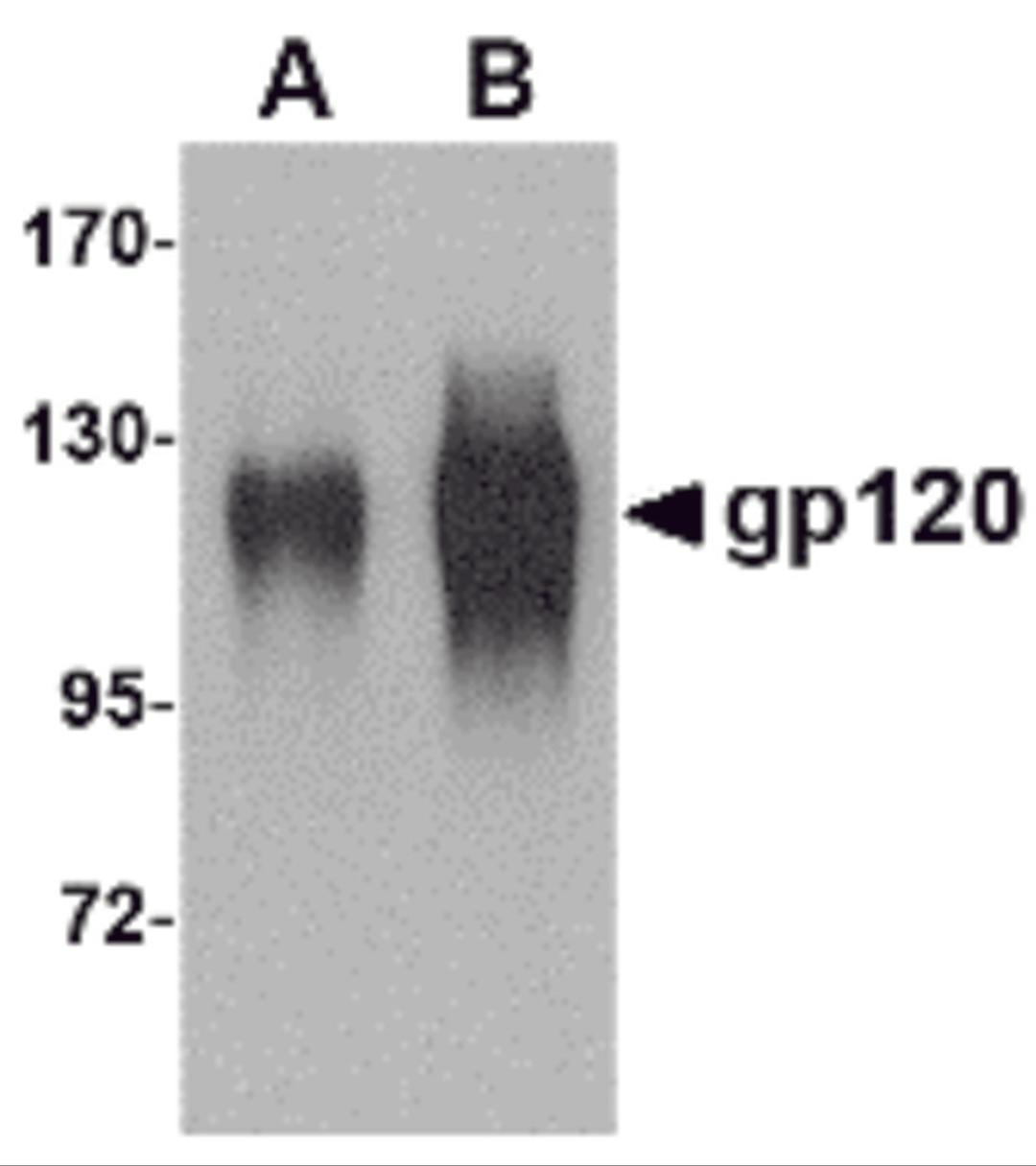 Western blot analysis of (A) 25 and (B) 100 ng of gp120 with gp120 antibody at 1 μg/mL.