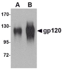 Western blot analysis of (A) 25 and (B) 100 ng of gp120 with gp120 antibody at 1 μg/mL.