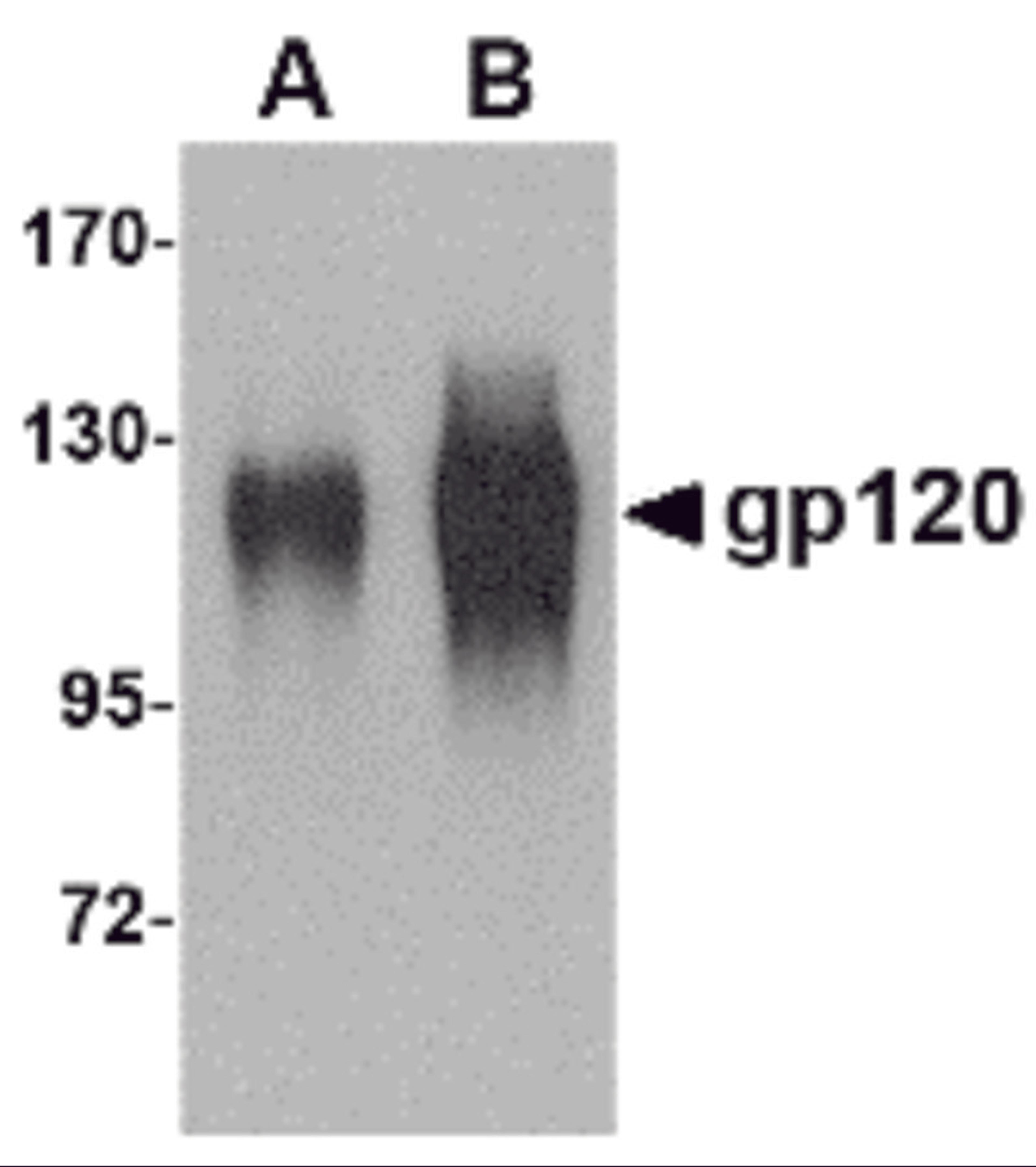 Western blot analysis of (A) 25 and (B) 100 ng of gp120 with gp120 antibody at 1 μg/mL.