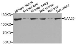 Western blot analysis of extracts of various cells using NAA25 antibody