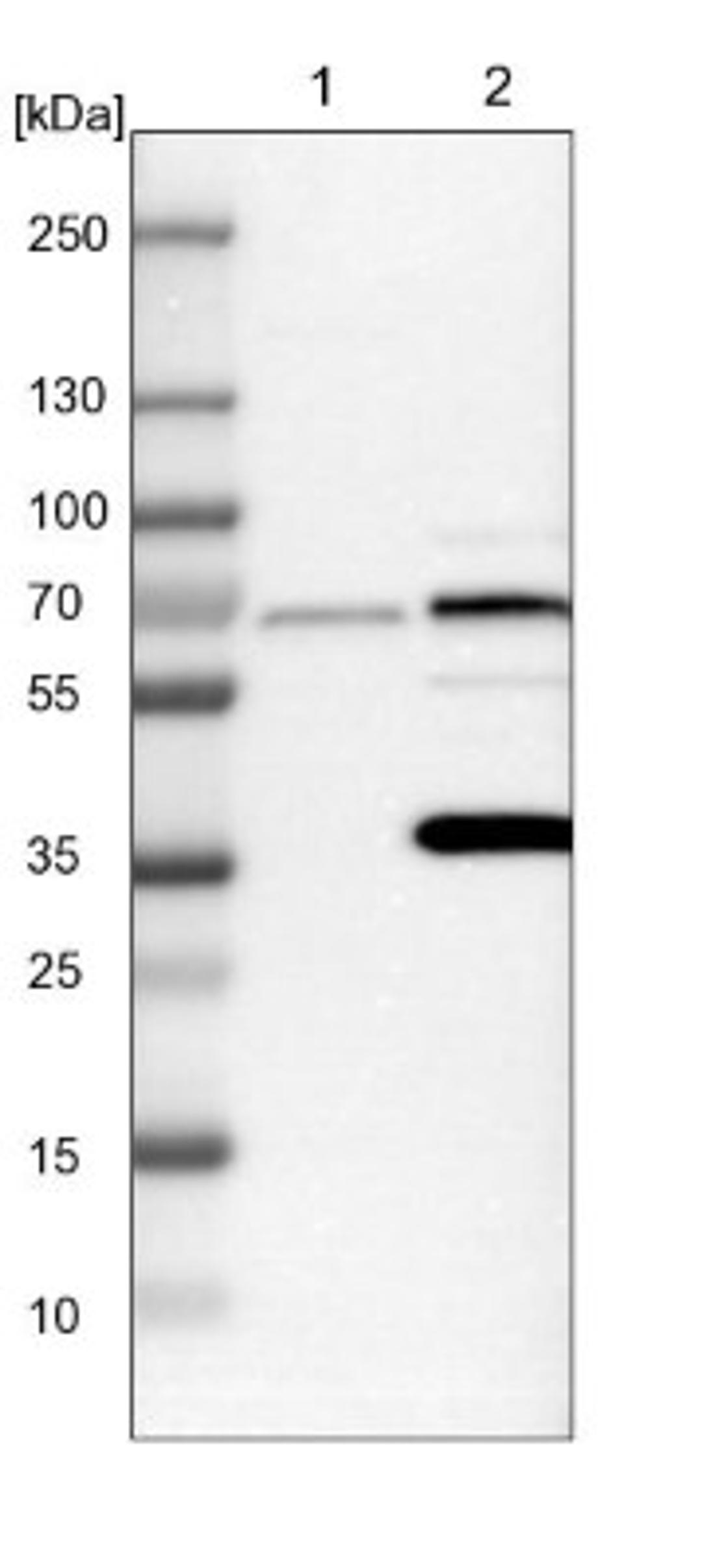 Western Blot: PICALM Antibody [NBP1-86658] - Lane 1: NIH-3T3 cell lysate (Mouse embryonic fibroblast cells)<br/>Lane 2: NBT-II cell lysate (Rat Wistar bladder tumour cells)