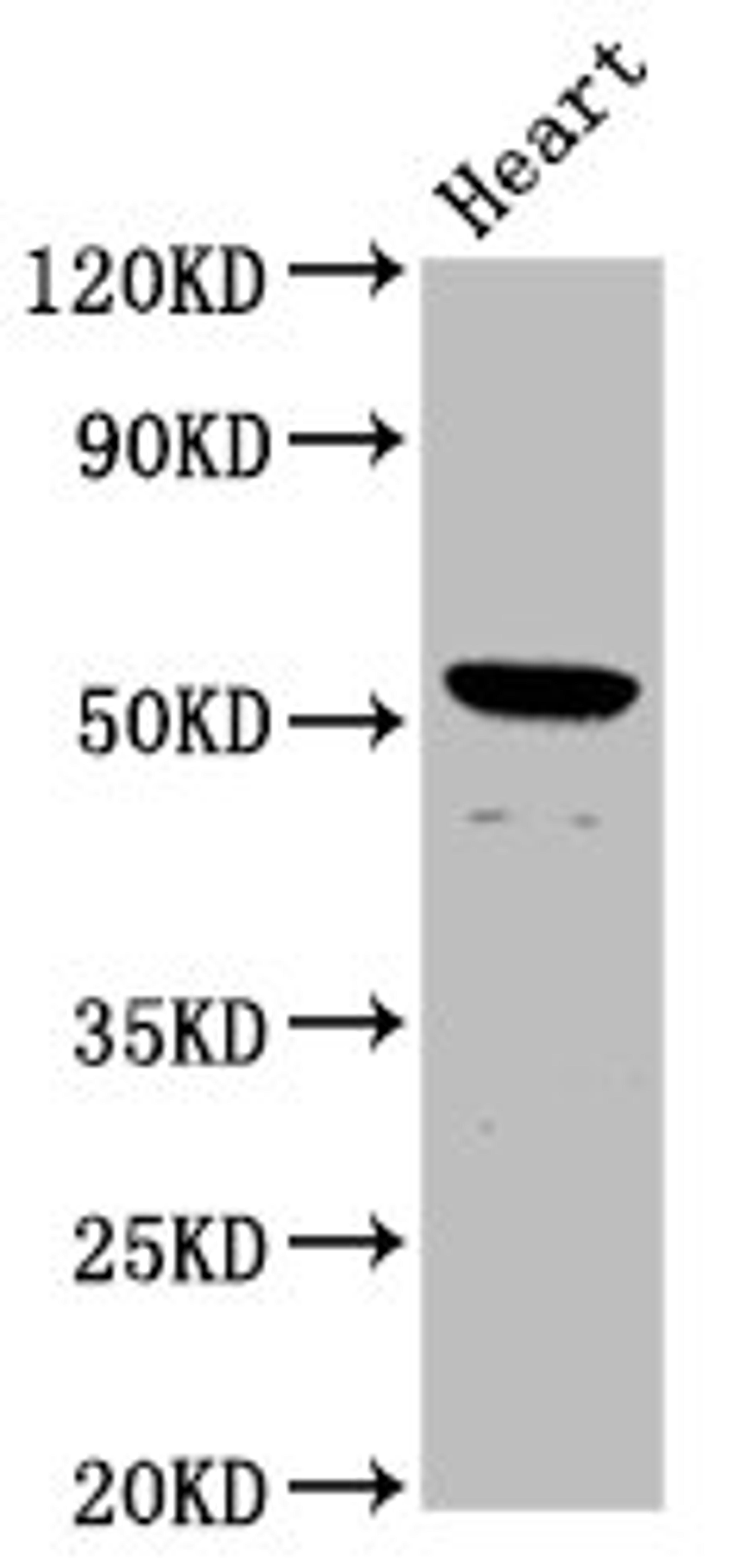 Western Blot. Positive WB detected in: Rat heart tissue. All lanes: NKD1 antibody at 1.8ug/ml. Secondary. Goat polyclonal to rabbit IgG at 1/50000 dilution. Predicted band size: 53 kDa. Observed band size: 53 kDa. 