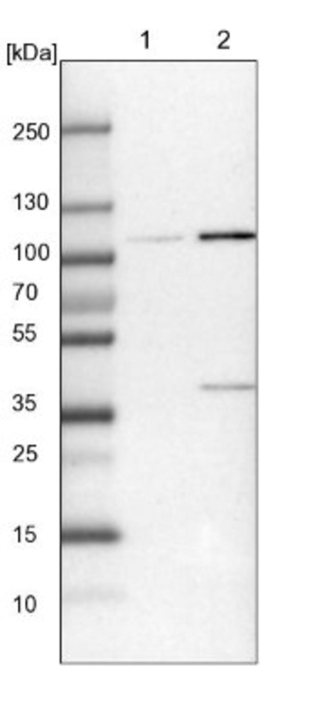 Western Blot: OTUD7B/Cezanne/ZA20D1 Antibody [NBP1-88095] - Lane 1: NIH-3T3 cell lysate (Mouse embryonic fibroblast cells)<br/>Lane 2: NBT-II cell lysate (Rat Wistar bladder tumour cells)