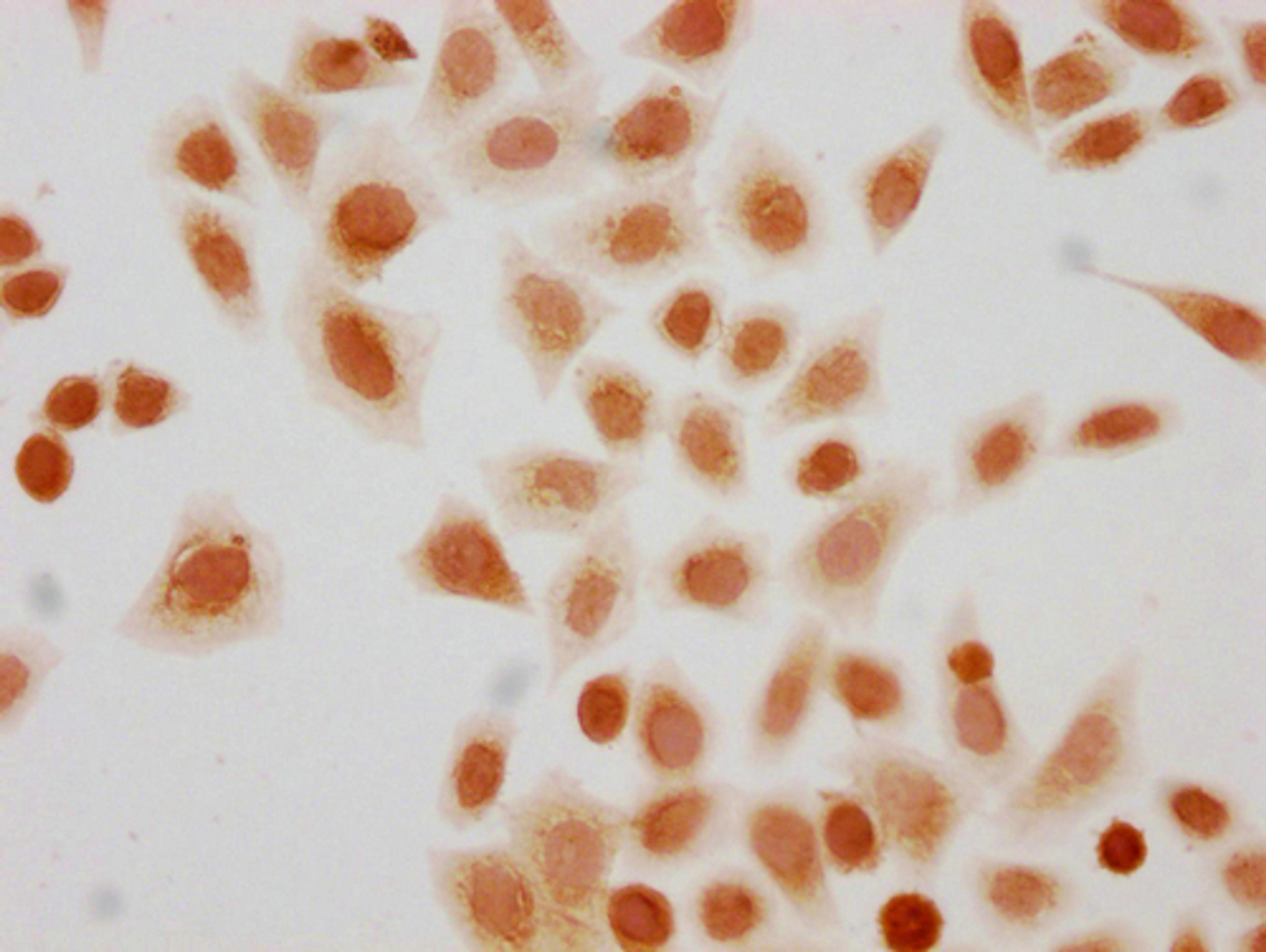 Immunocytochemistry analysis of CSB-PA010418PA56sucHU diluted at 1:10 and staining in Hela cells(treated with 10mM disodium succinylate for 4h) performed on a Leica BondTM system. The cells were fixed in 4% formaldehyde, permeabilized using 0.2% Triton X-100 and blocked with 10% normal goat serum 30min at RT. Then primary antibody (1% BSA) was incubated at 4°C overnight. The primary is detected by a biotinylated secondary antibody and visualized using an HRP conjugated SP system.