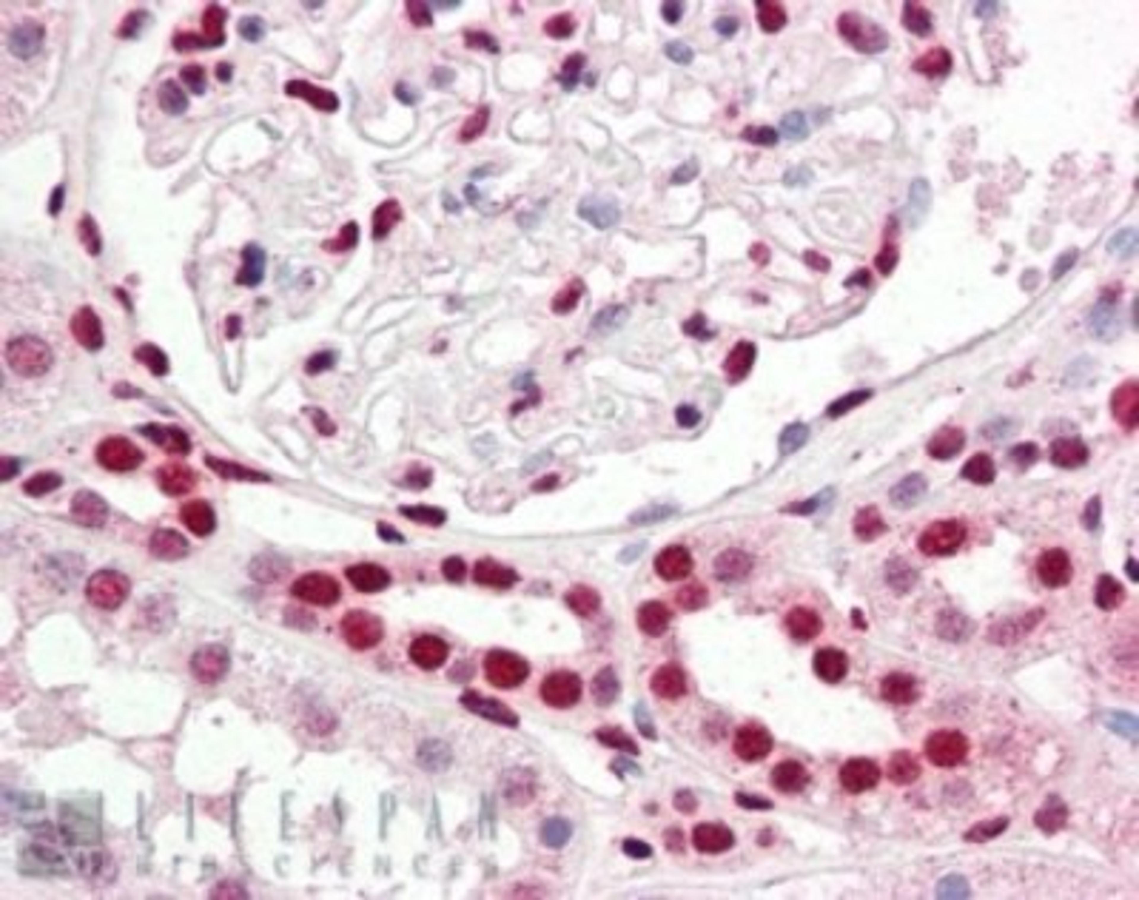 Immunohistochemistry-Paraffin: IRF6 Antibody [NBP1-51911] - staining.