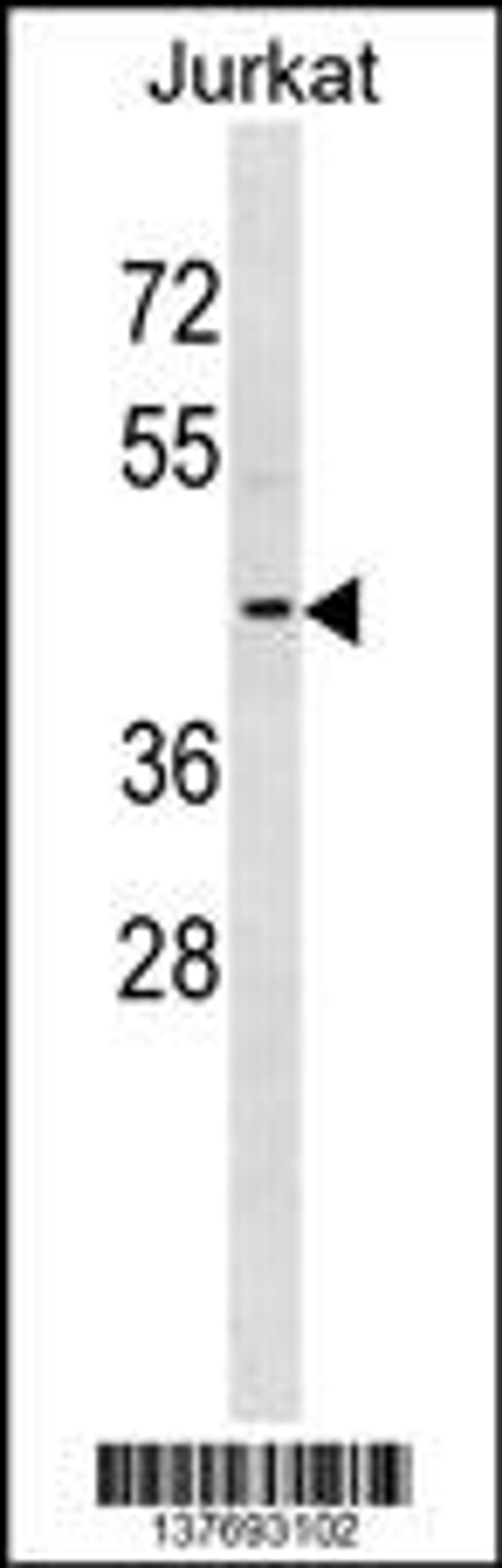 Western blot analysis in Jurkat cell line lysates (35ug/lane).