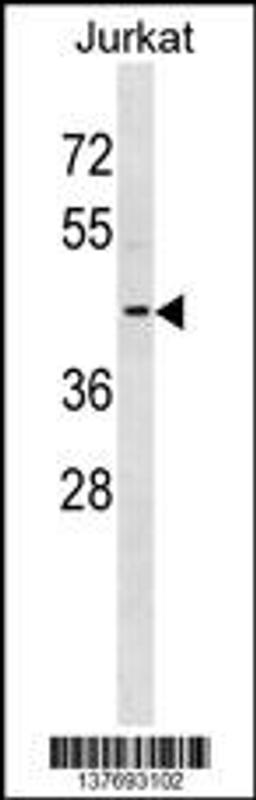 Western blot analysis in Jurkat cell line lysates (35ug/lane).