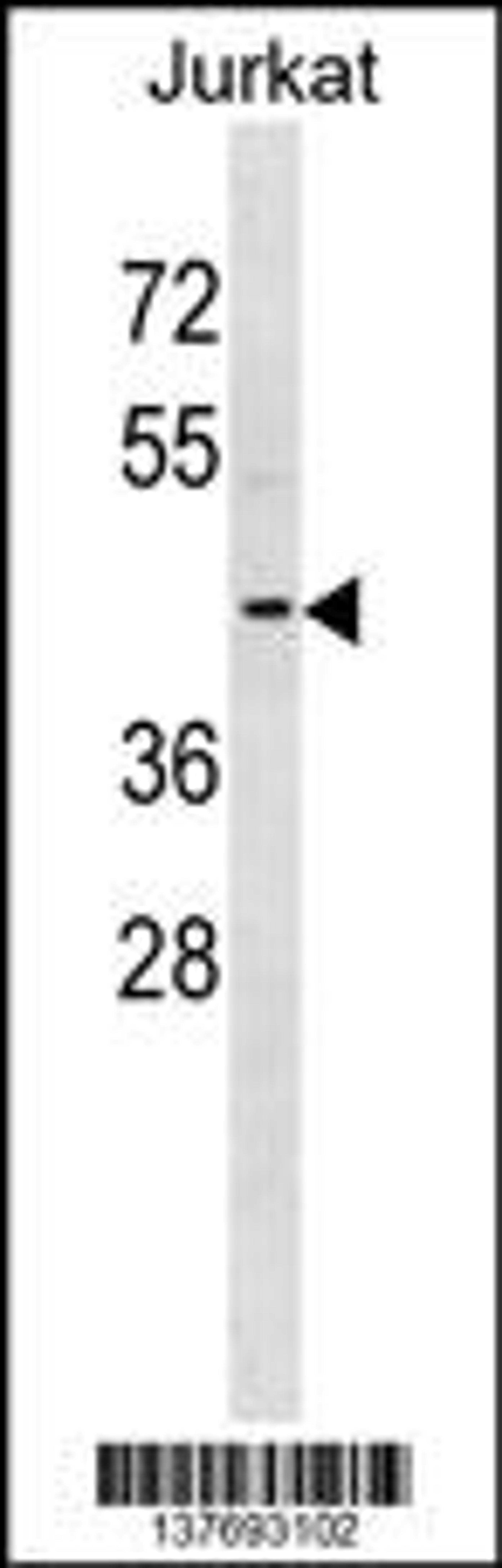 Western blot analysis in Jurkat cell line lysates (35ug/lane).