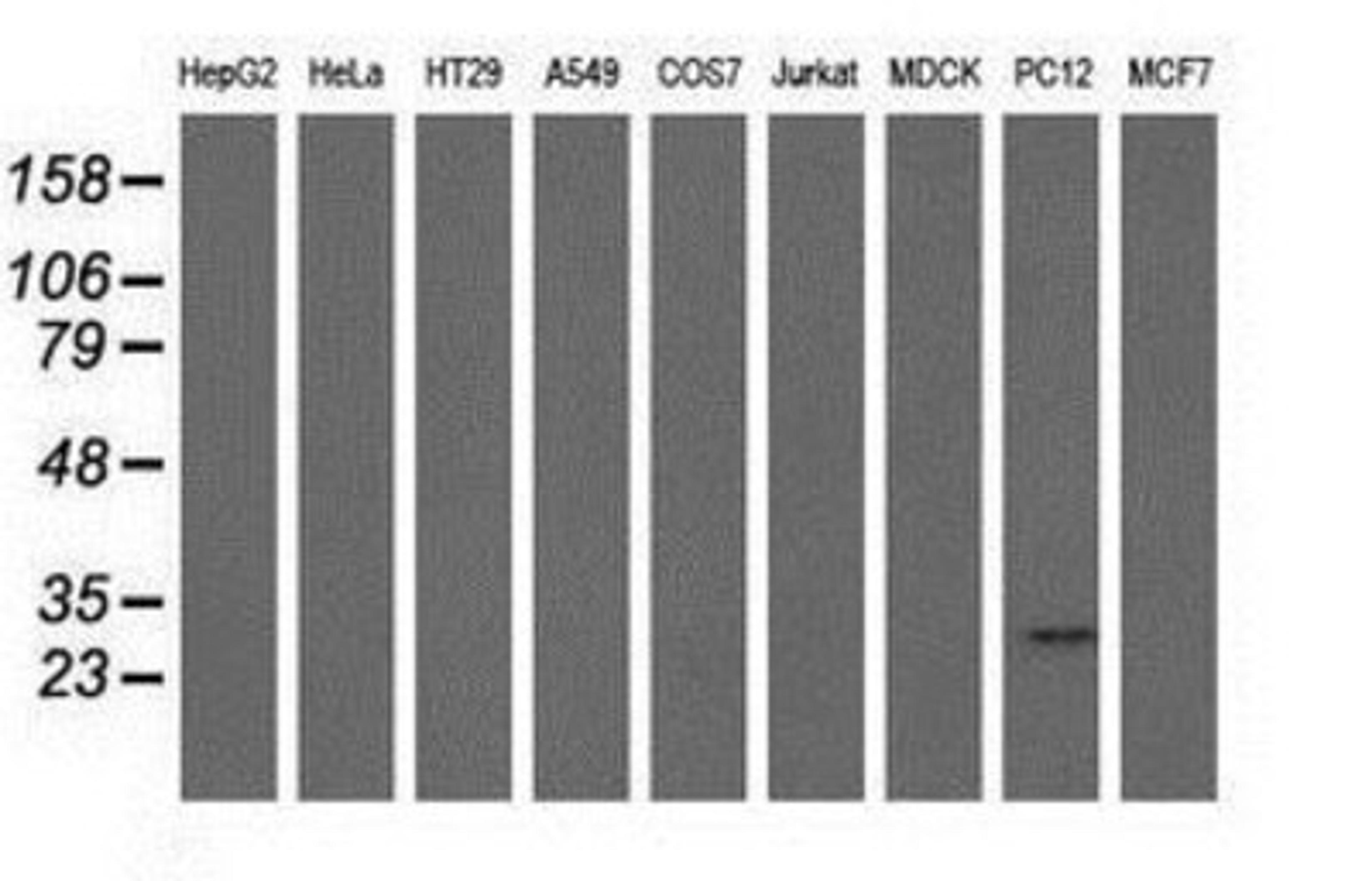 Western Blot: mu Crystallin Antibody (1G7) [NBP2-02829] Analysis of extracts (35ug) from 9 different cell lines by using anti-mu Crystallin monoclonal antibody.