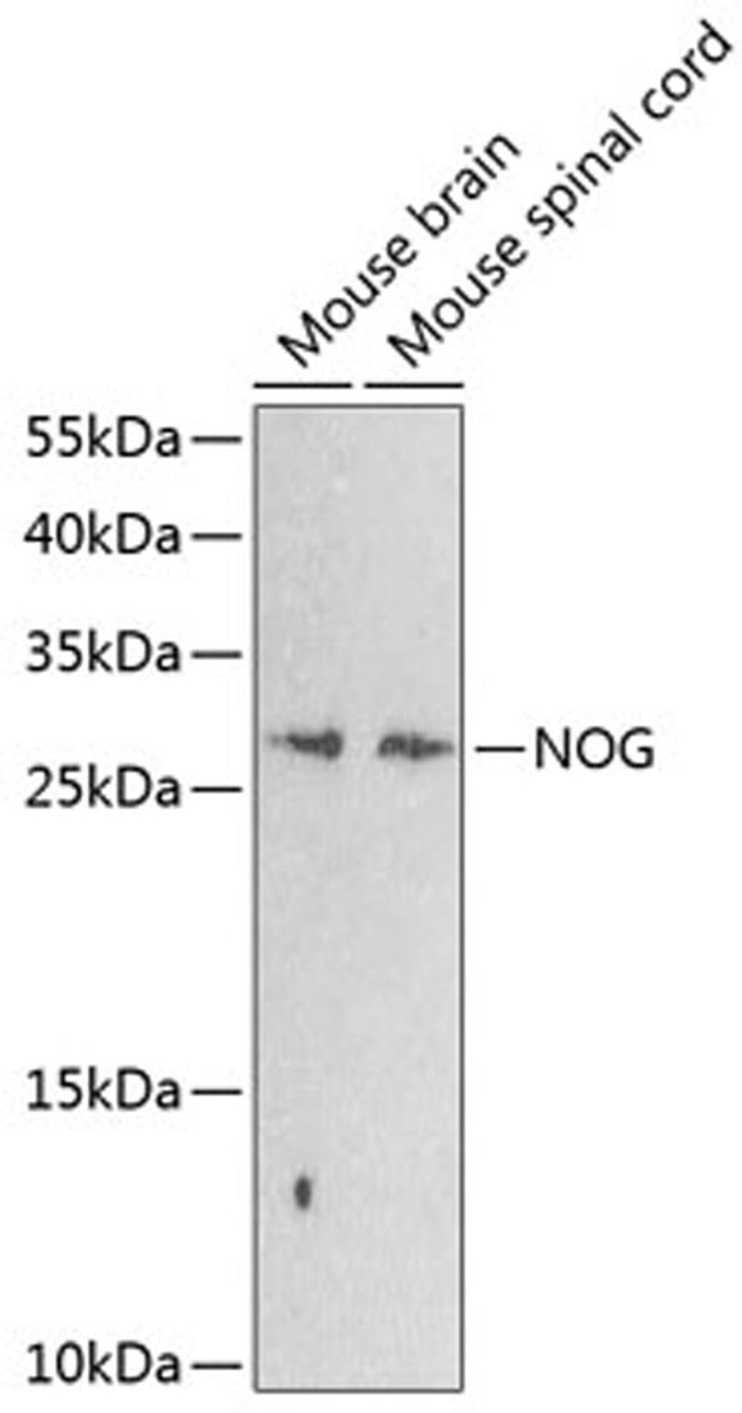 Western blot - NOG antibody (A8305)