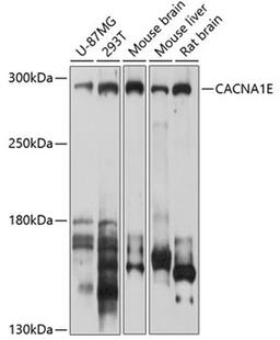 Western blot - CACNA1E antibody (A10203)