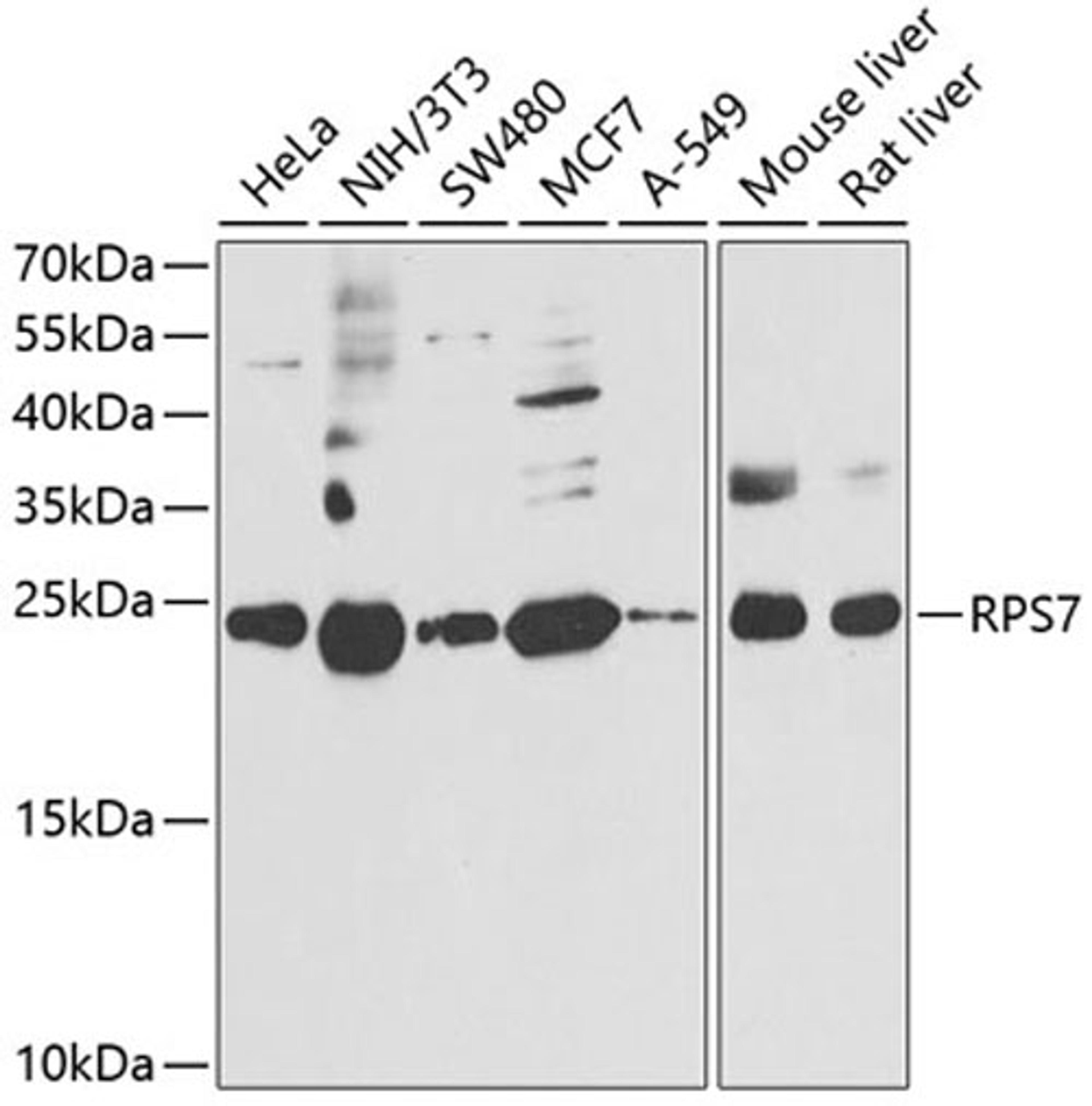 Western blot - RPS7 antibody (A6731)