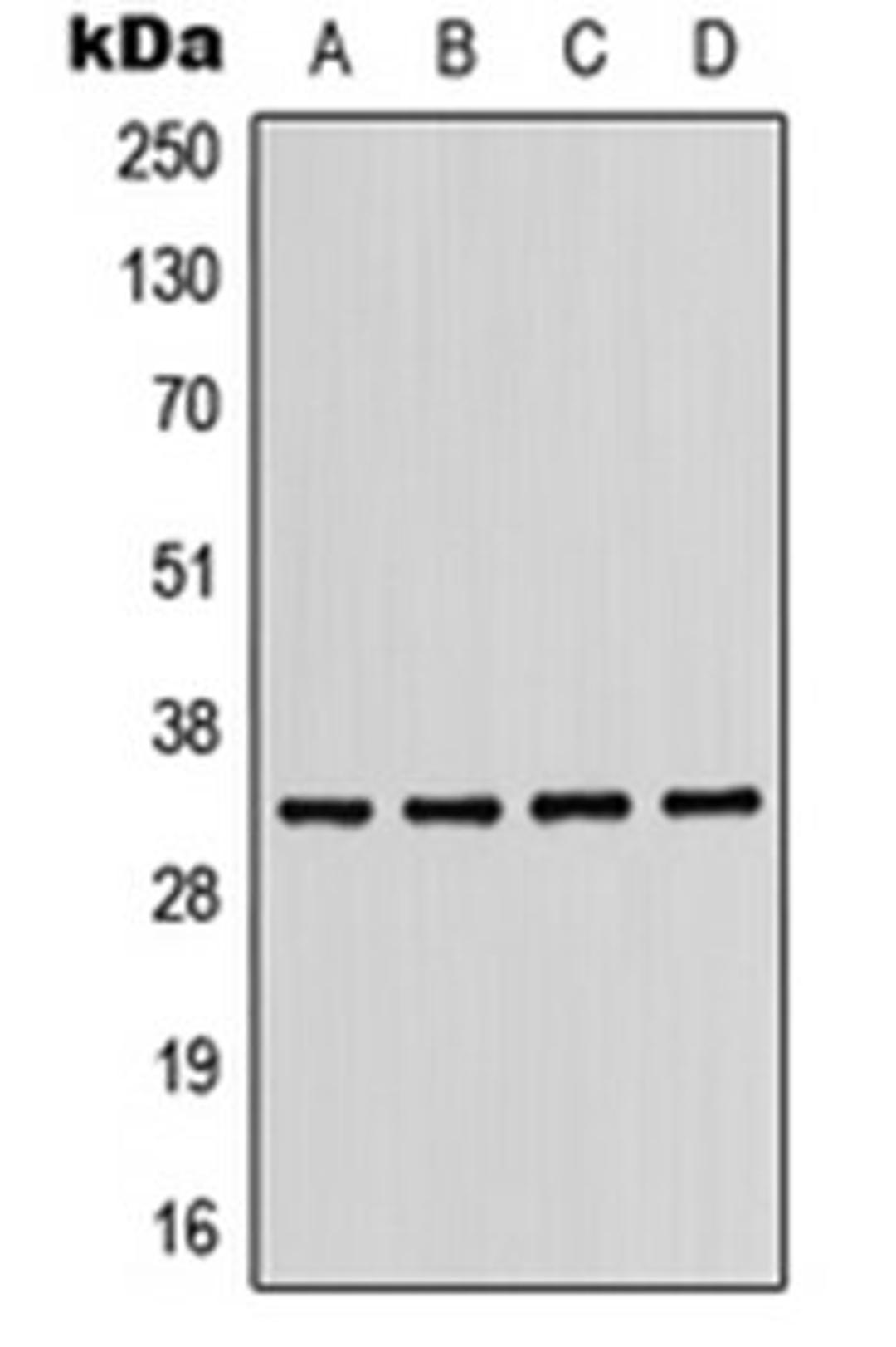 Western blot analysis of MDAMB231 (Lane 1), Jurkat (Lane 2), mouse liver (Lane 3), H9C2 (Lane 4) whole cell lysates using KIR2DL2 antibody