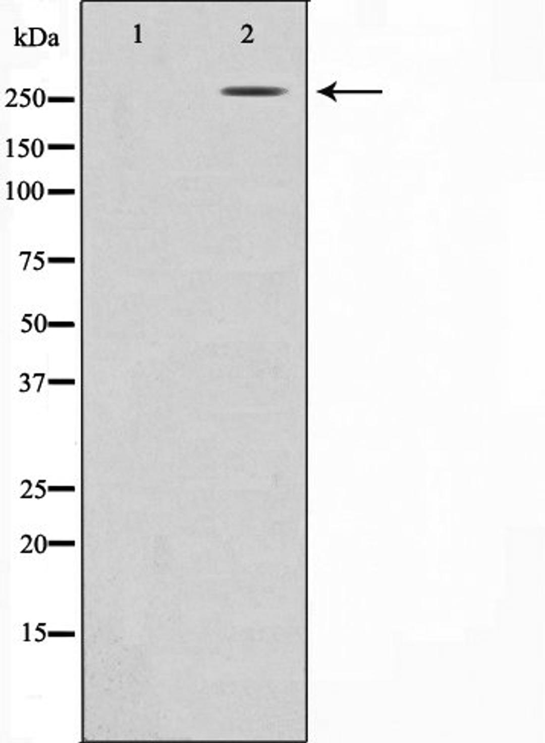 Western blot analysis of HeLa cell lysate using Fibronectin 1 antibody