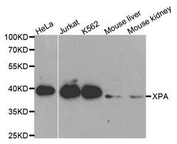 Western blot analysis of extracts of various cell lines using XPA antibody