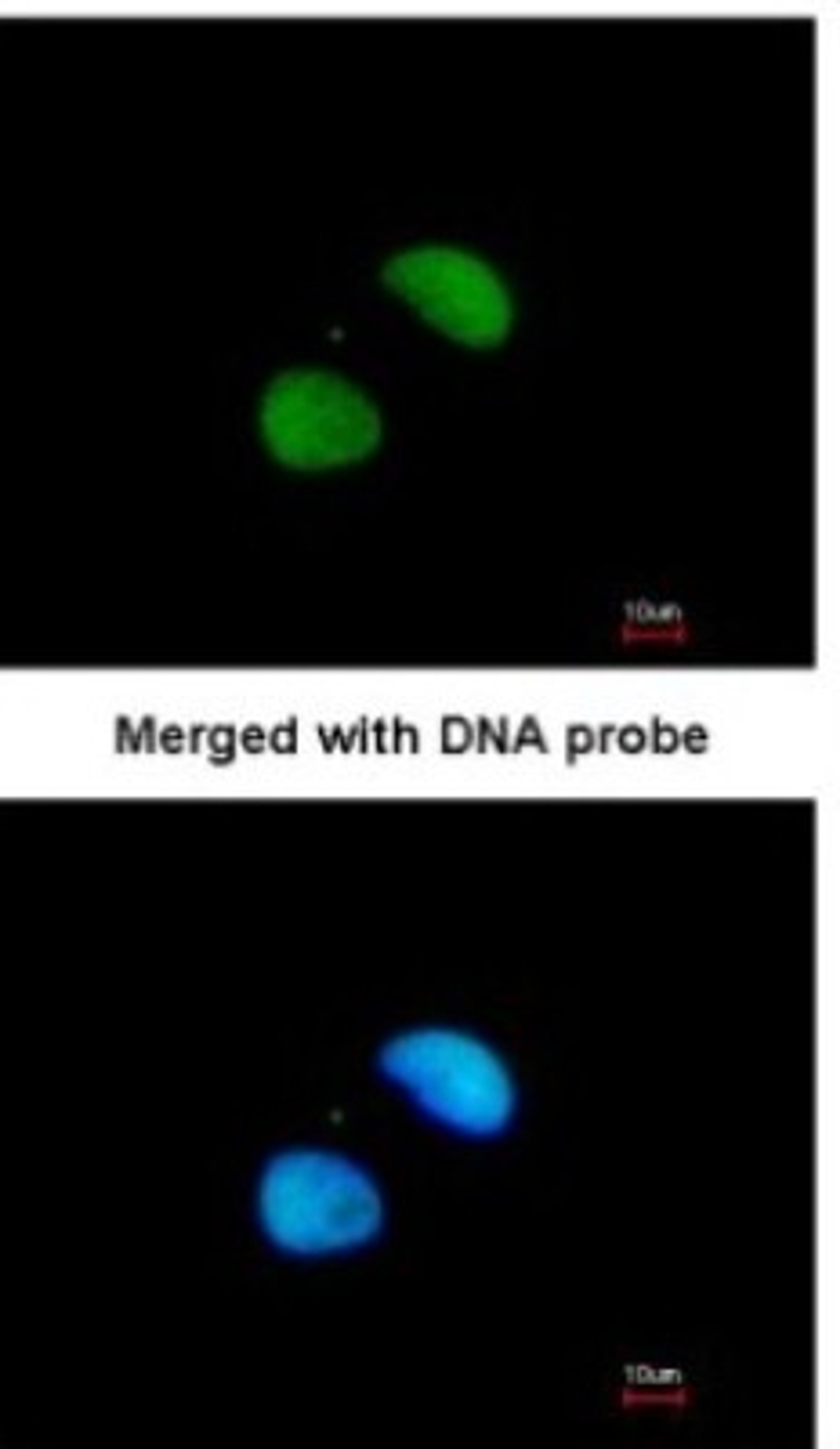 Immunocytochemistry/Immunofluorescence: XRCC4 Antibody [NBP1-31339] - Paraformaldehyde-fixed HeLa, using antibody at 1:200 dilution.