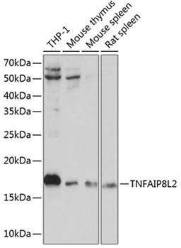 Western blot - TNFAIP8L2 Polyclonal Antibody (A13698)