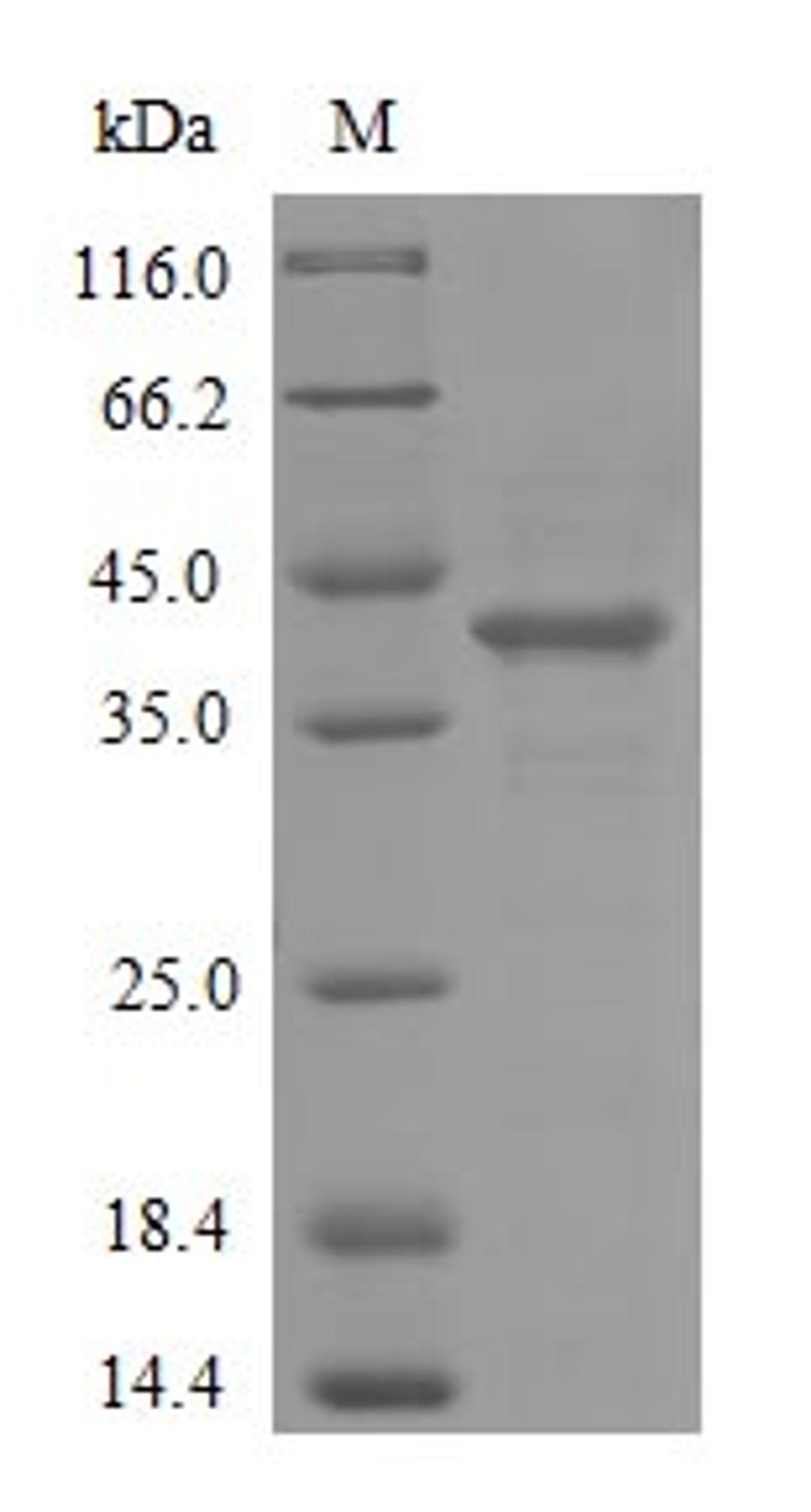 (Tris-Glycine gel) Discontinuous SDS-PAGE (reduced) with 5% enrichment gel and 15% separation gel.