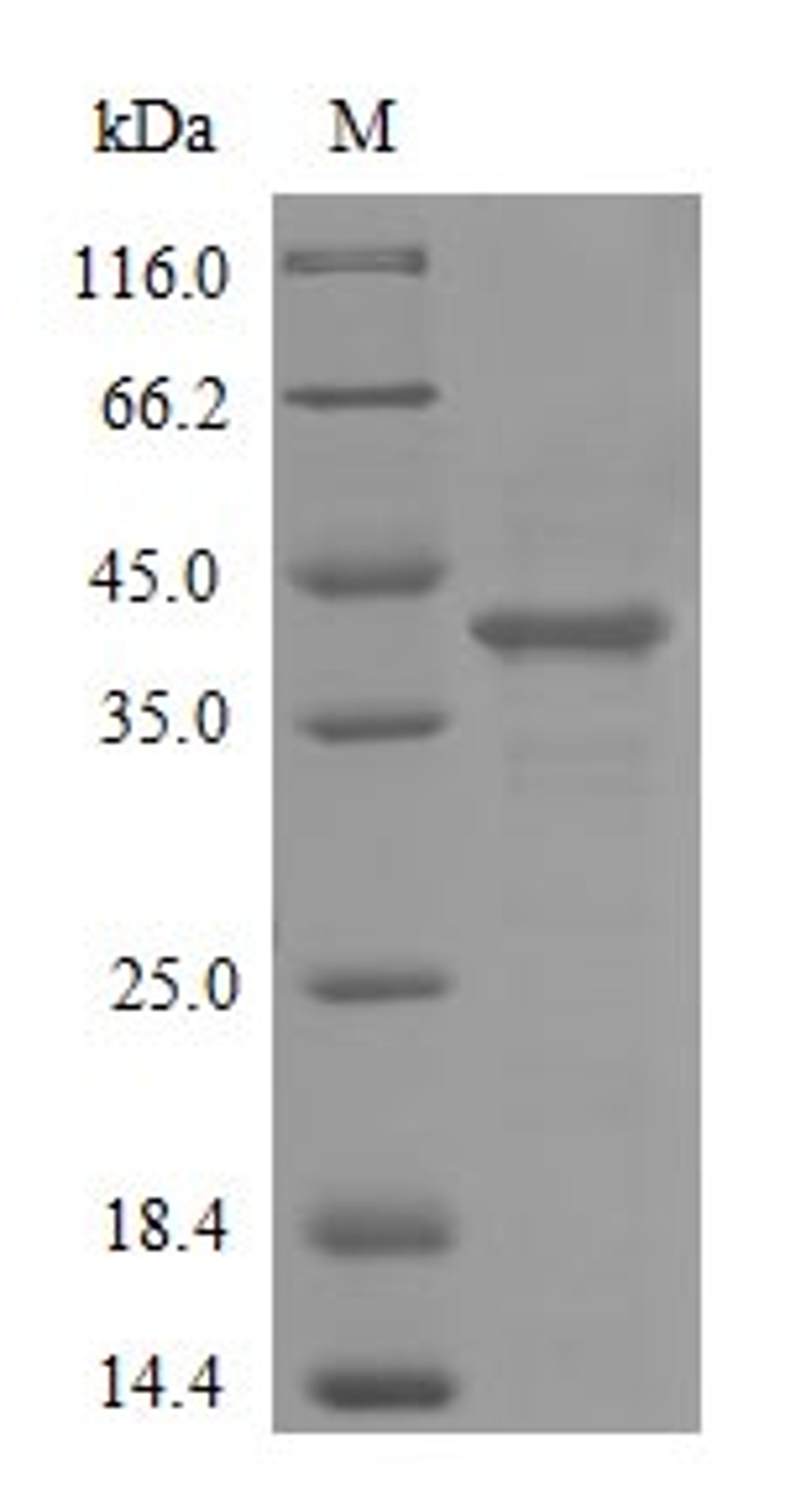 (Tris-Glycine gel) Discontinuous SDS-PAGE (reduced) with 5% enrichment gel and 15% separation gel.