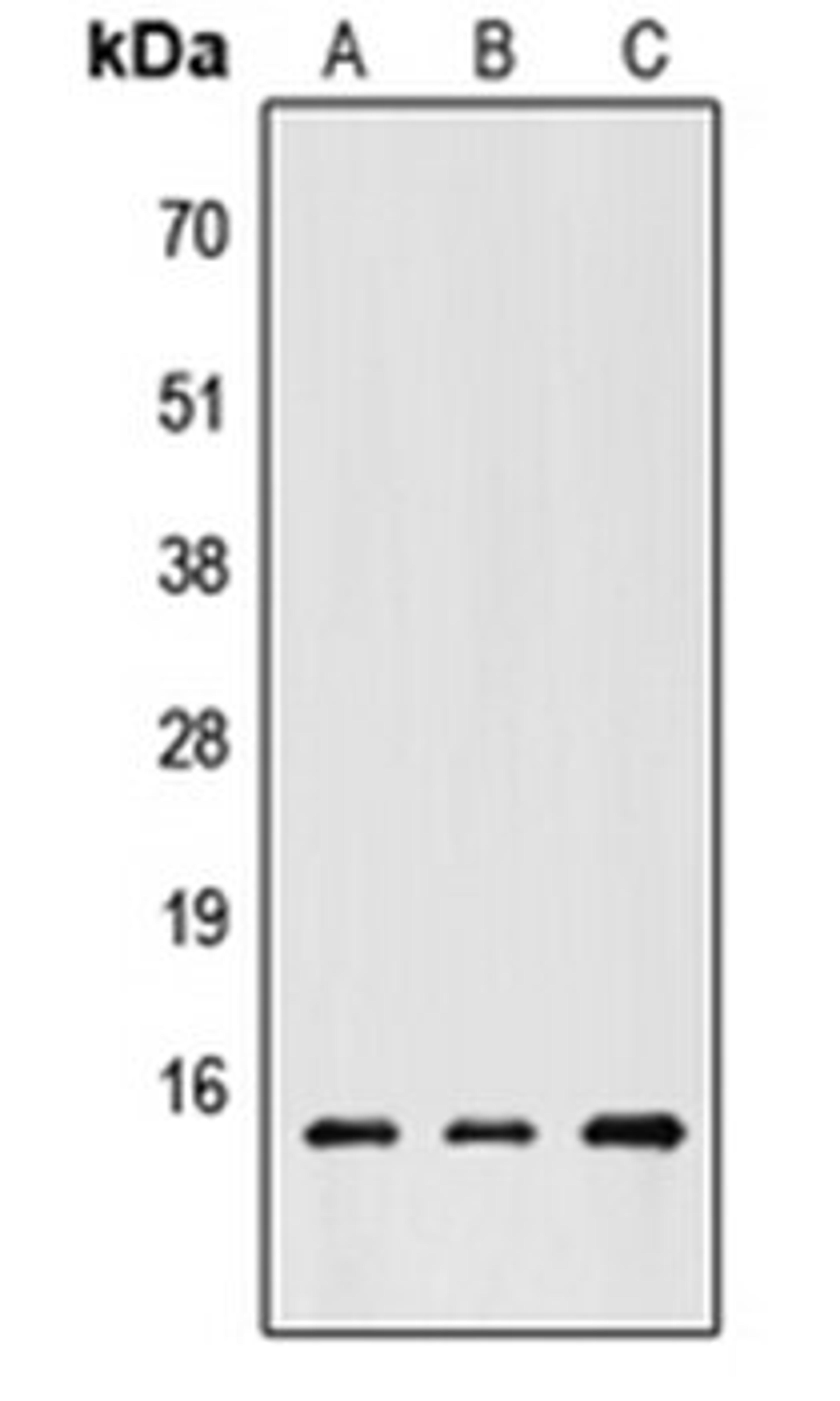 Western blot analysis of HEK293T (Lane 1), Raw264.7 (Lane 2), PC12 (Lane 3) whole cell lysates using CHRAC1 antibody